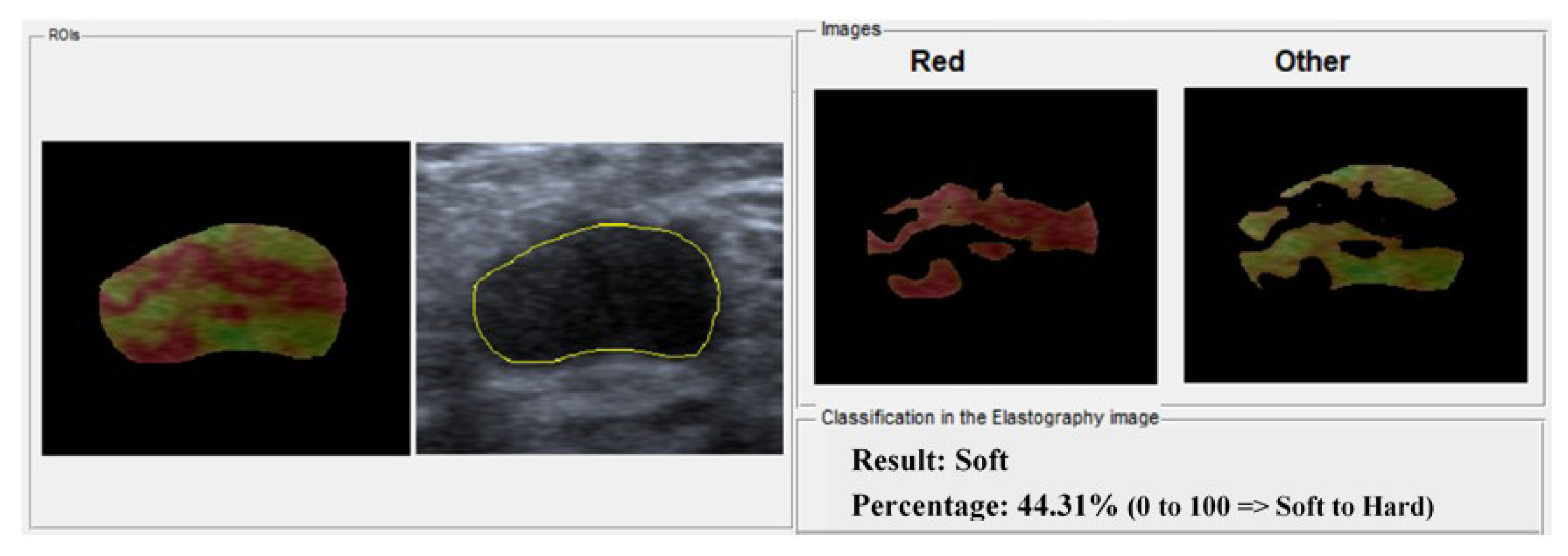 Bioengineering 05 00062 g005 Bioengineering 05 00062 g005