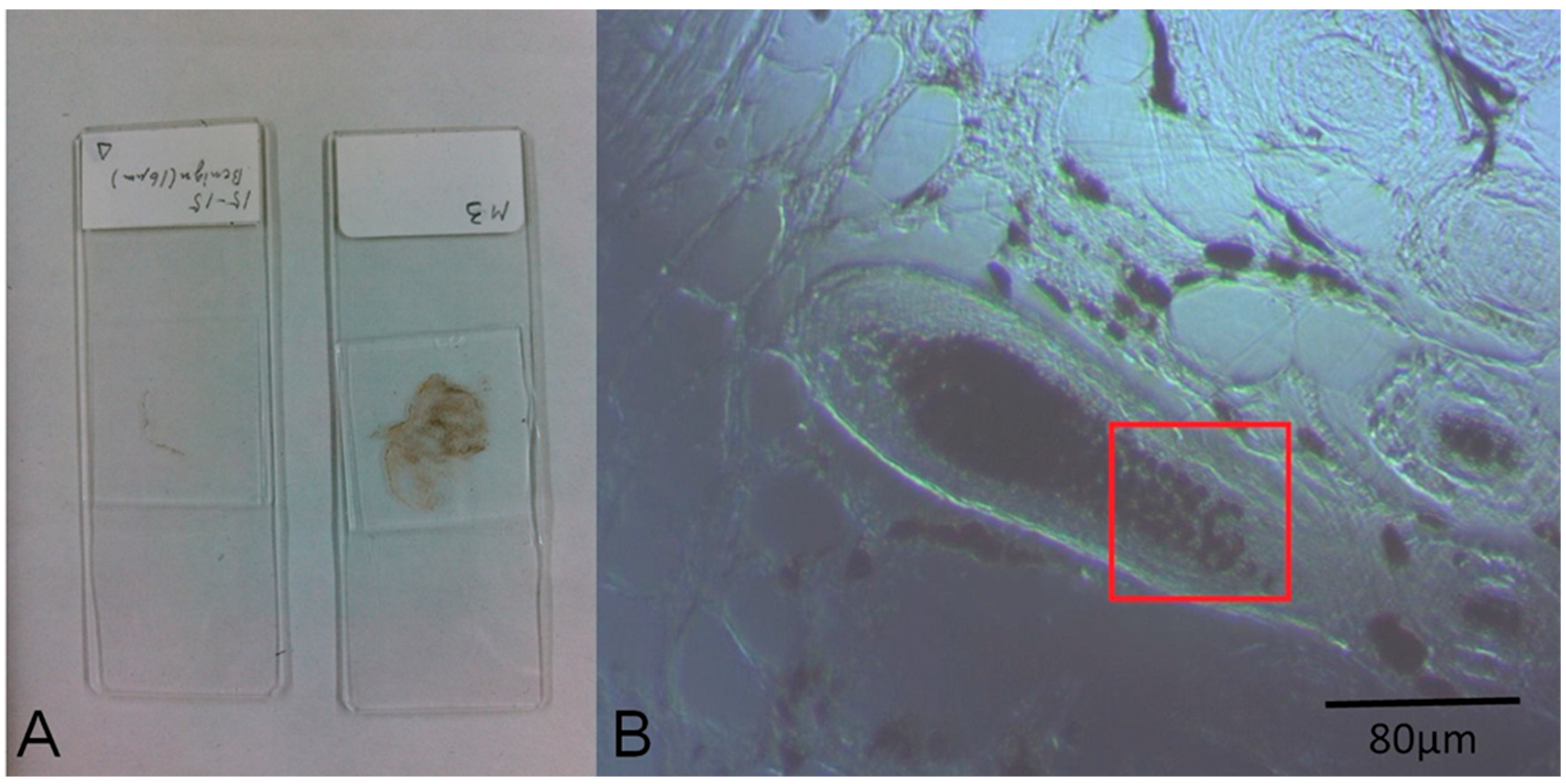 Bioengineering 05 00067 g002