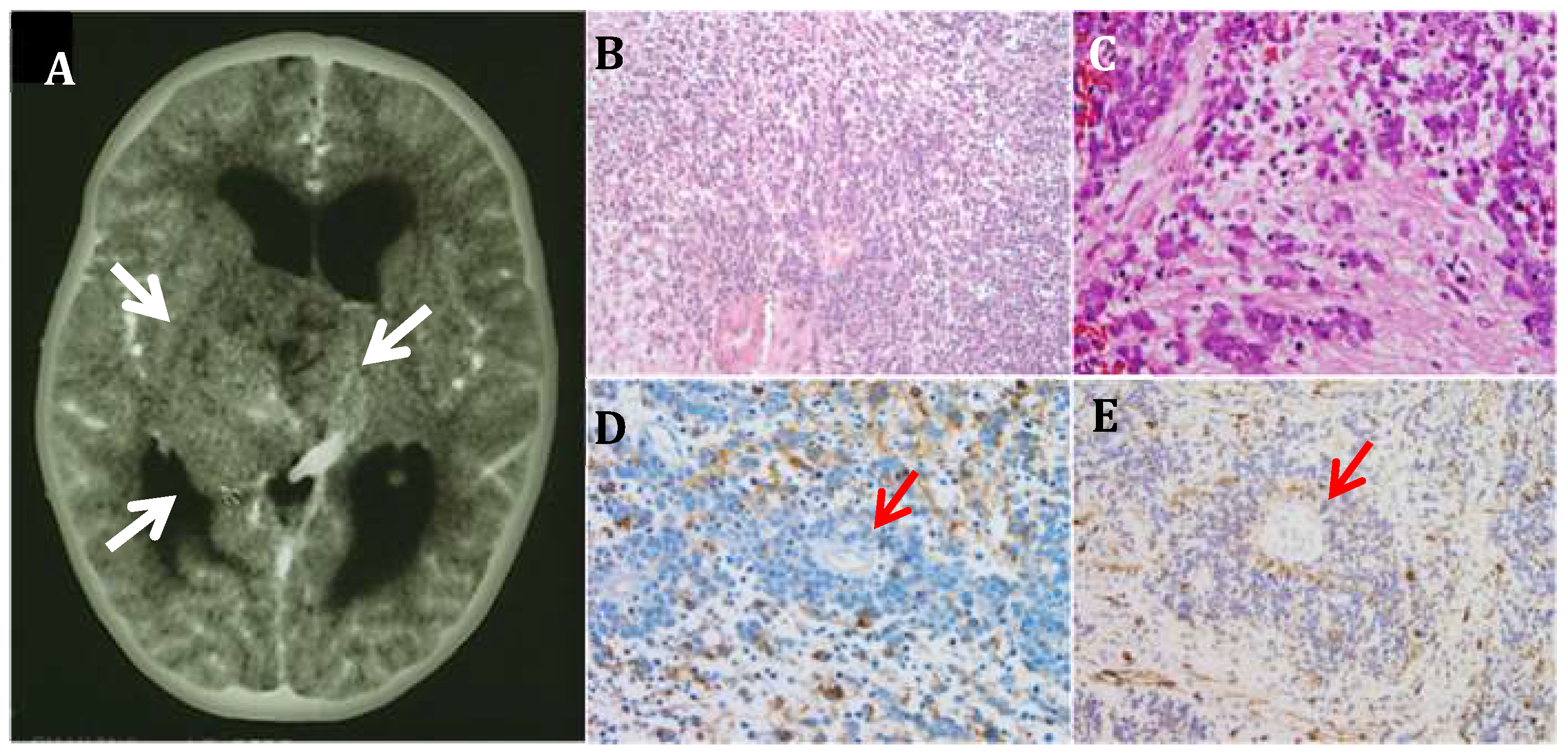 Bioengineering 05 00096 g001