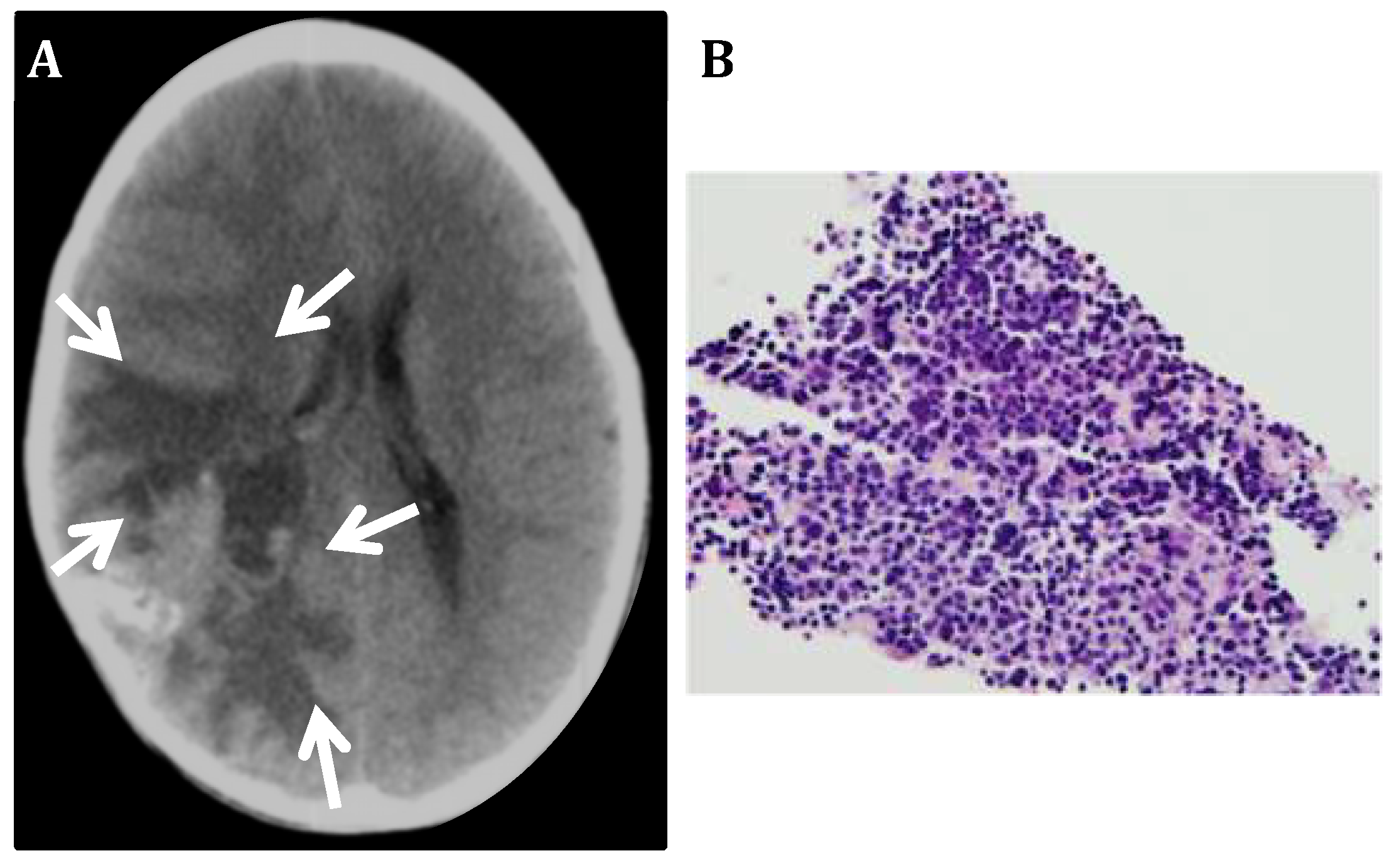 Bioengineering 05 00096 g002