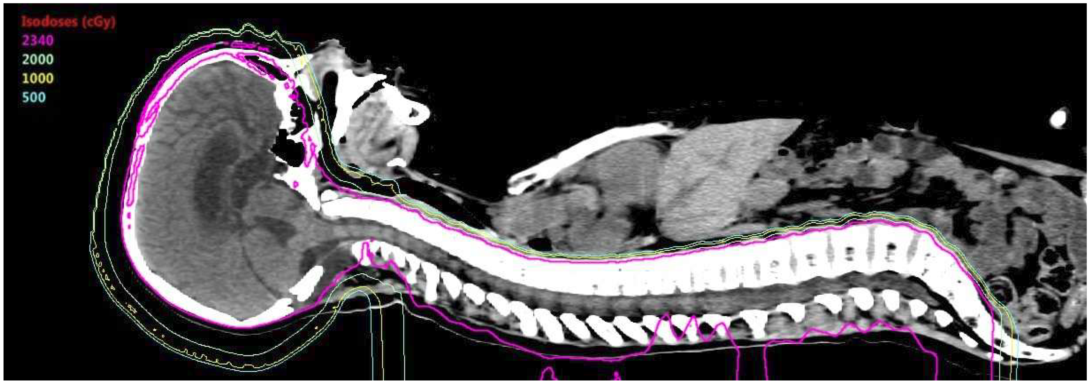 Bioengineering 05 00097 g002