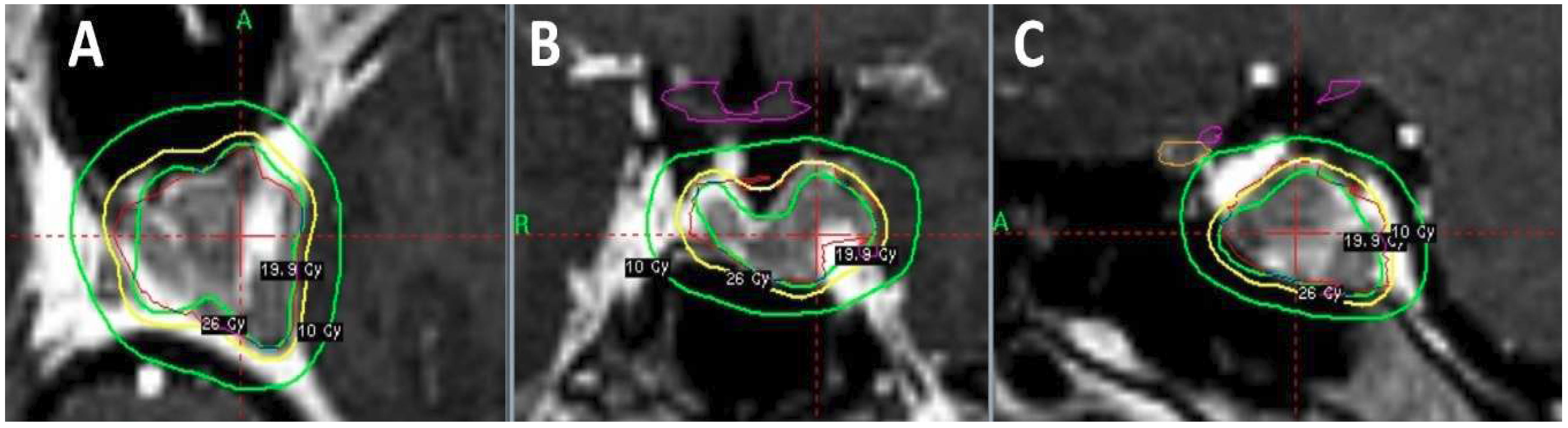 Bioengineering 05 00097 g003