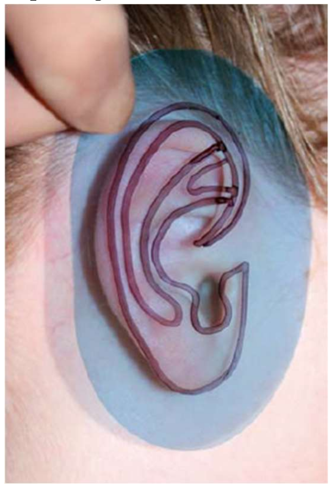 Bioengineering 06 00014 g005