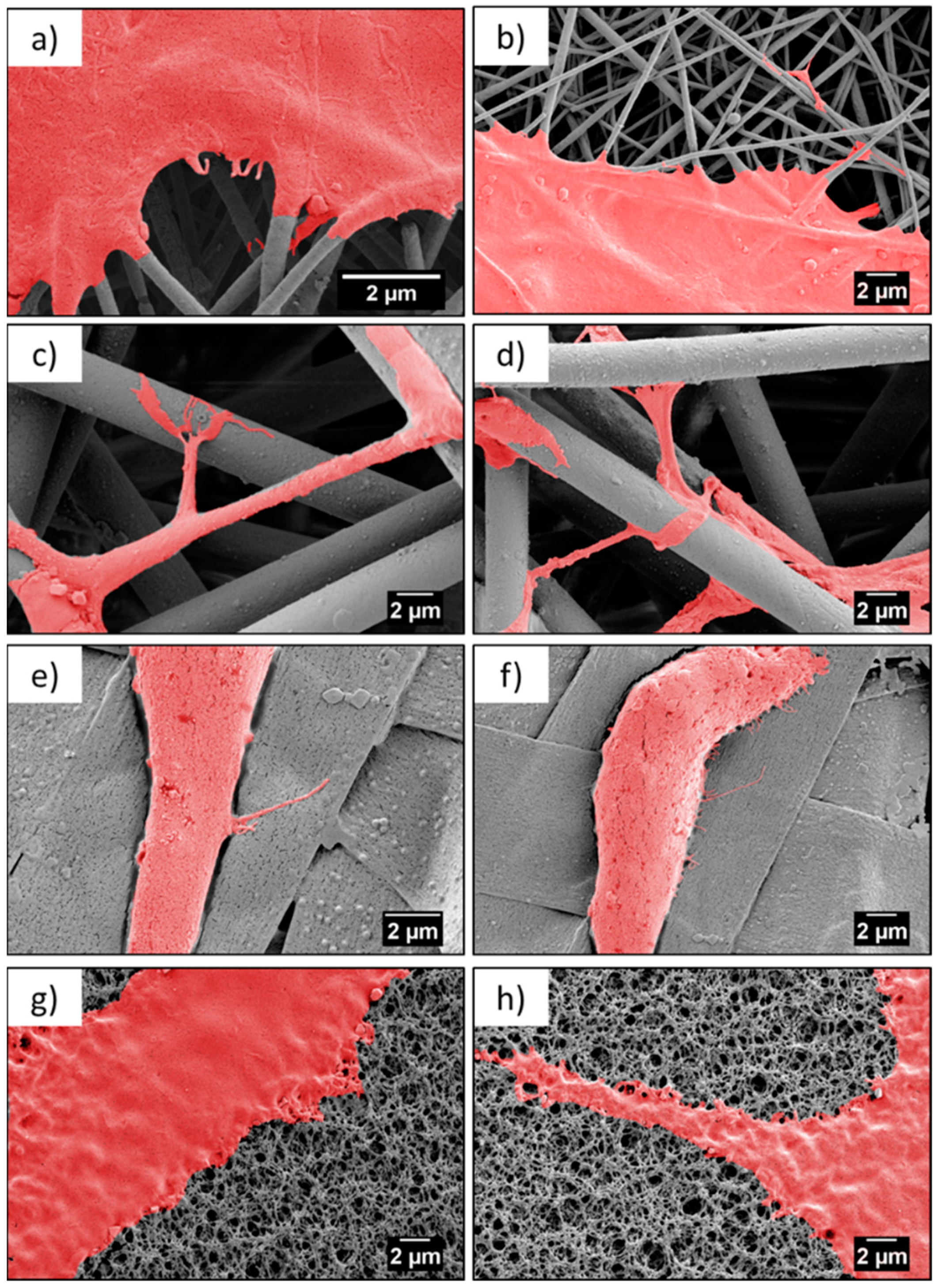 Bioengineering 06 00041 g006 Bioengineering 06 00041 g006