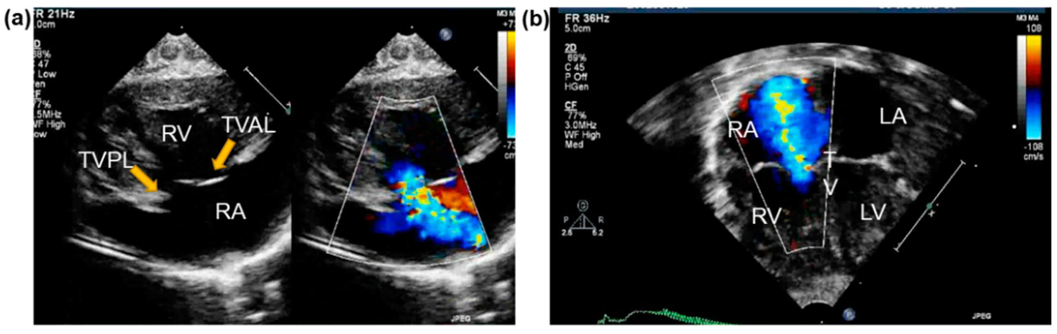 Bioengineering 06 00047 g005