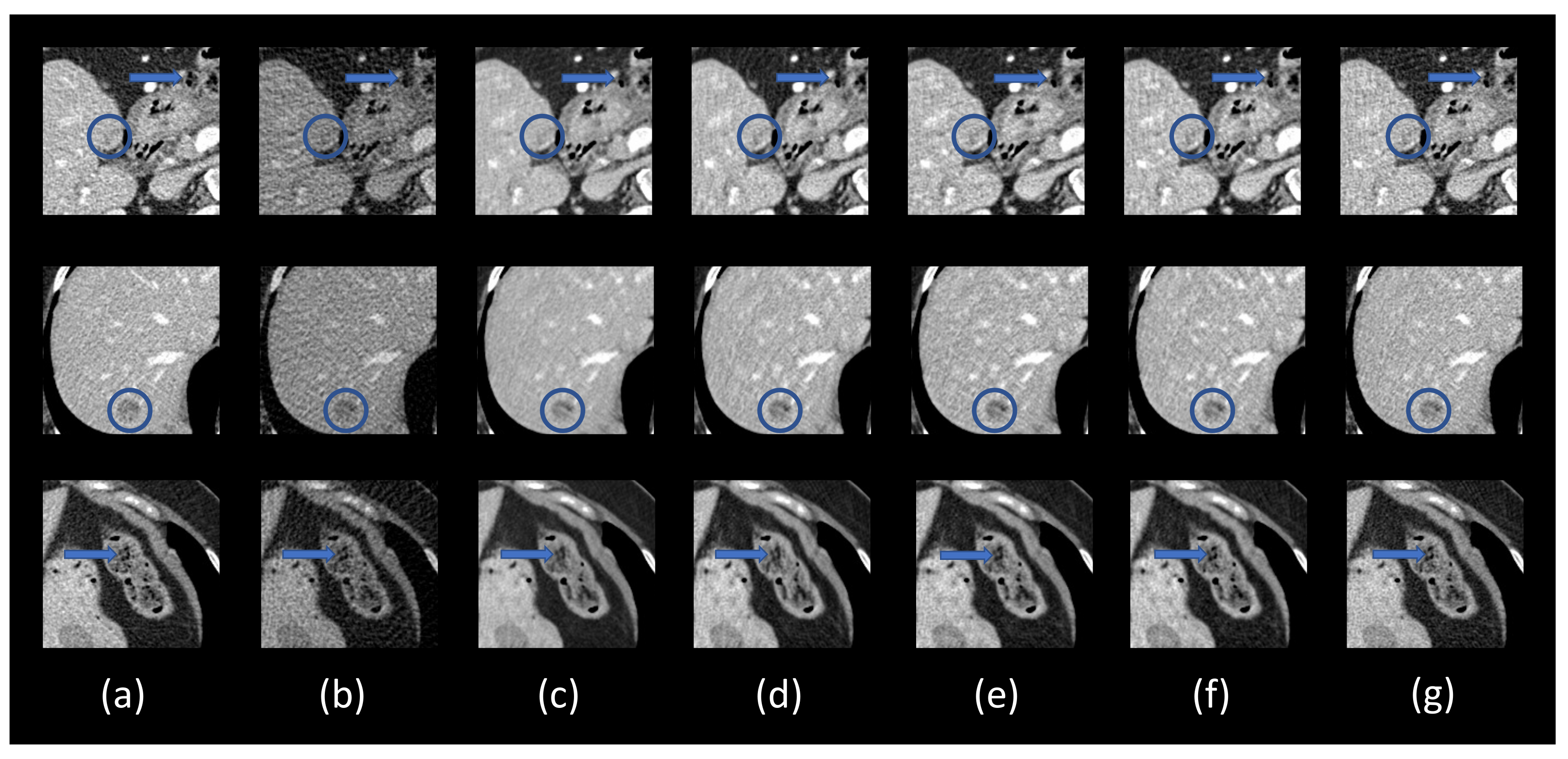 Bioengineering 06 00111 g006