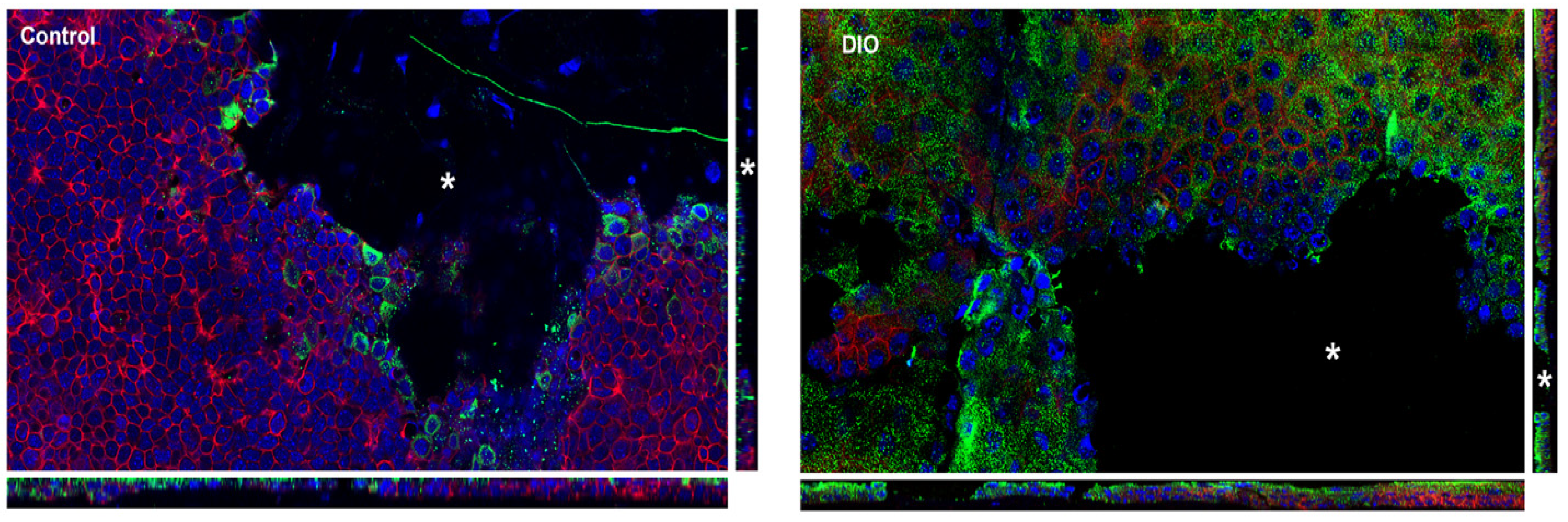 Bioengineering 07 00014 g004