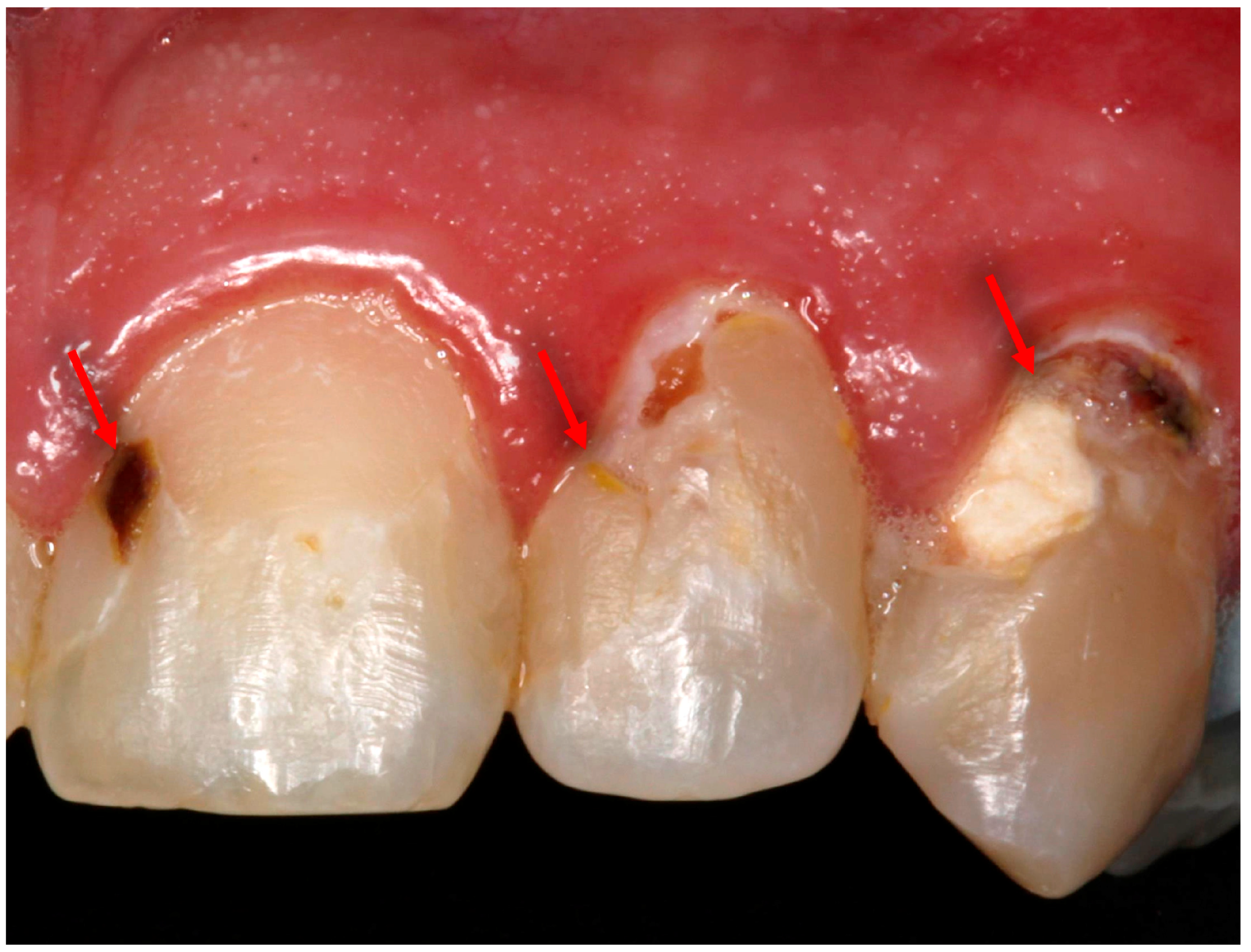 Bioengineering 07 00083 g001 Bioengineering 07 00083 g001