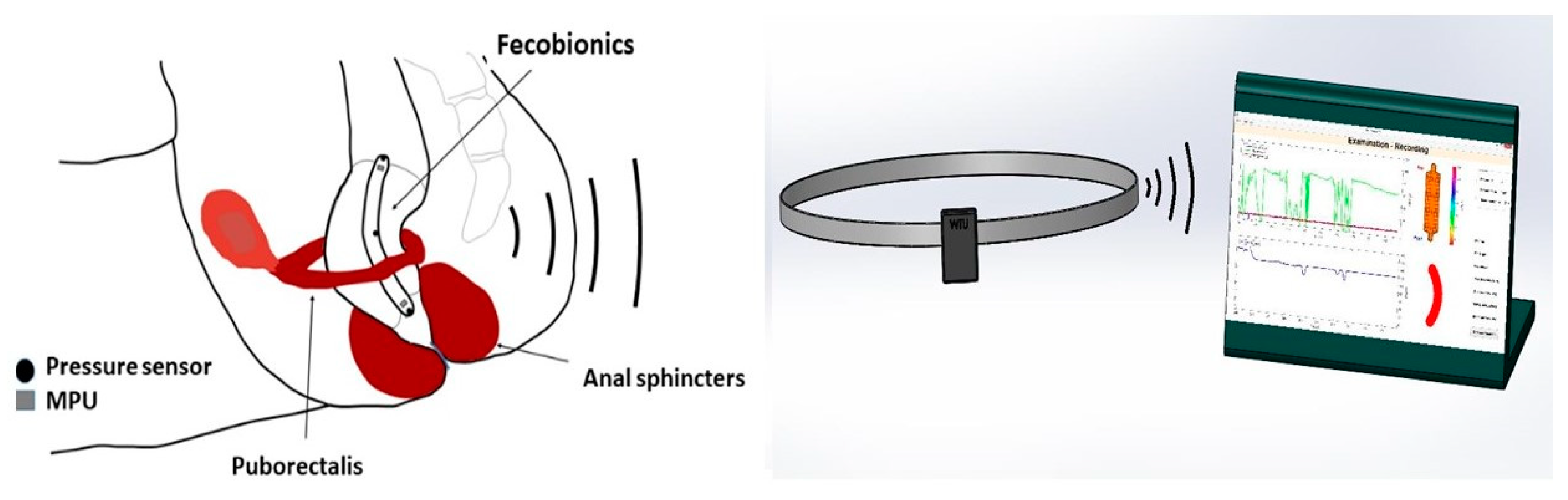 Bioengineering 07 00146 g001