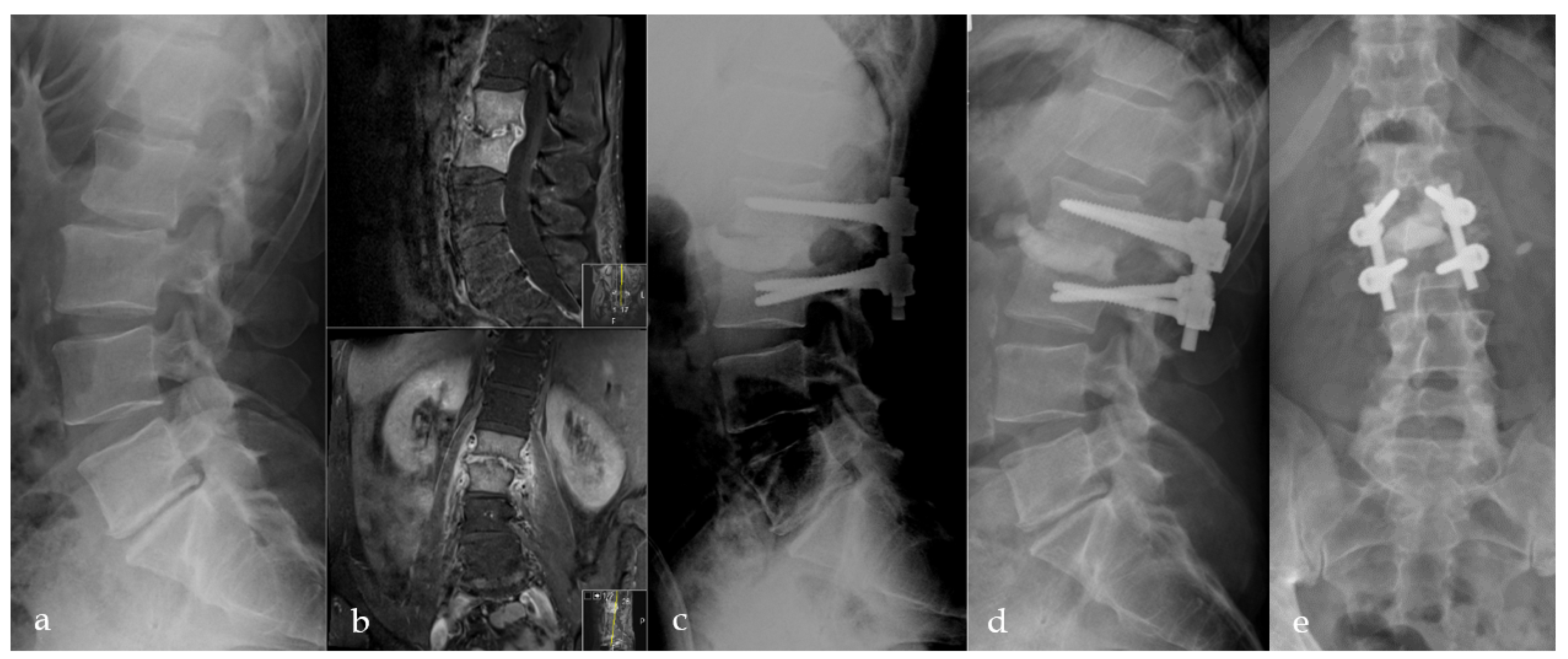 Bioengineering 09 00073 g004