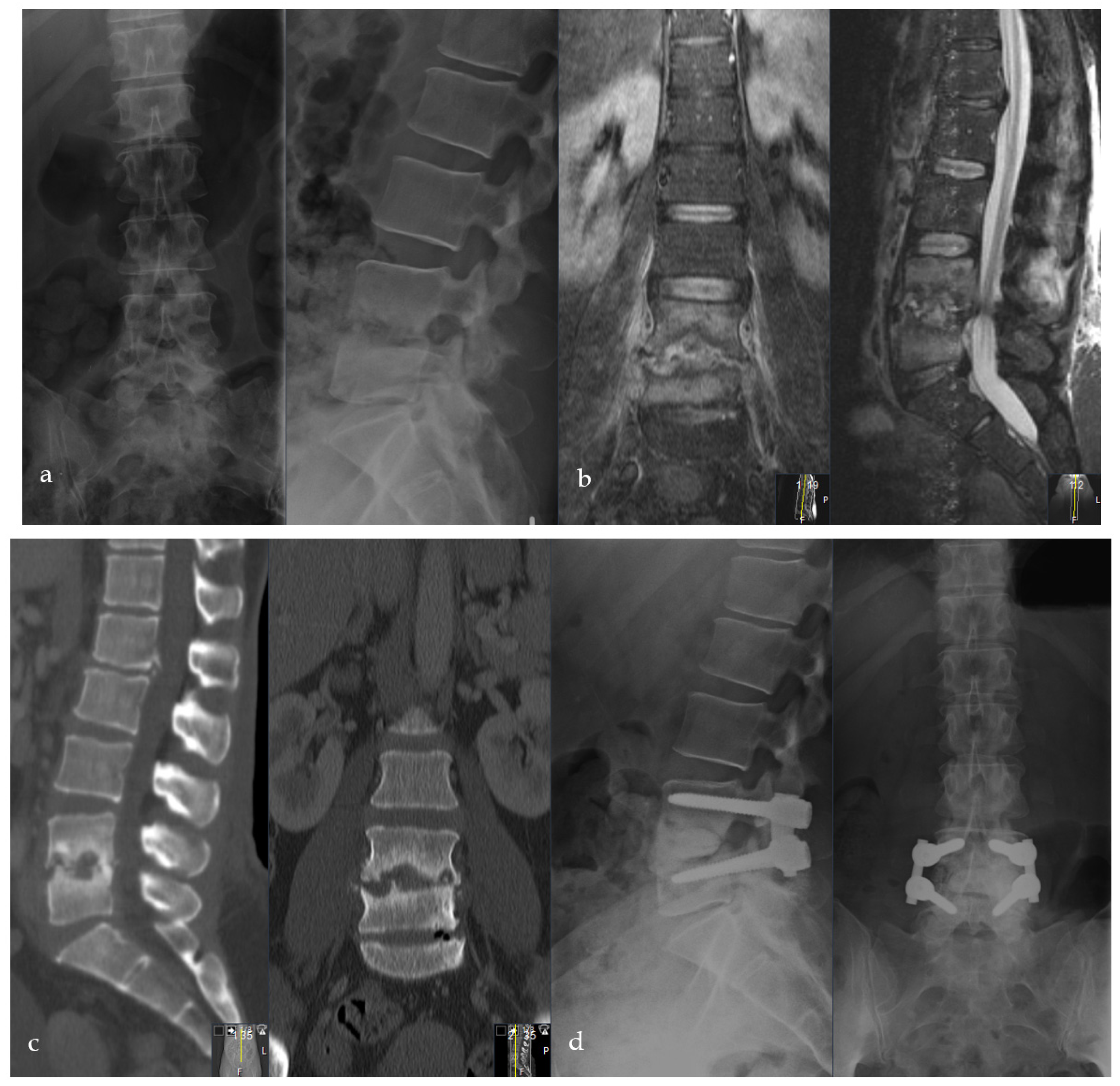 Bioengineering 09 00073 g005a