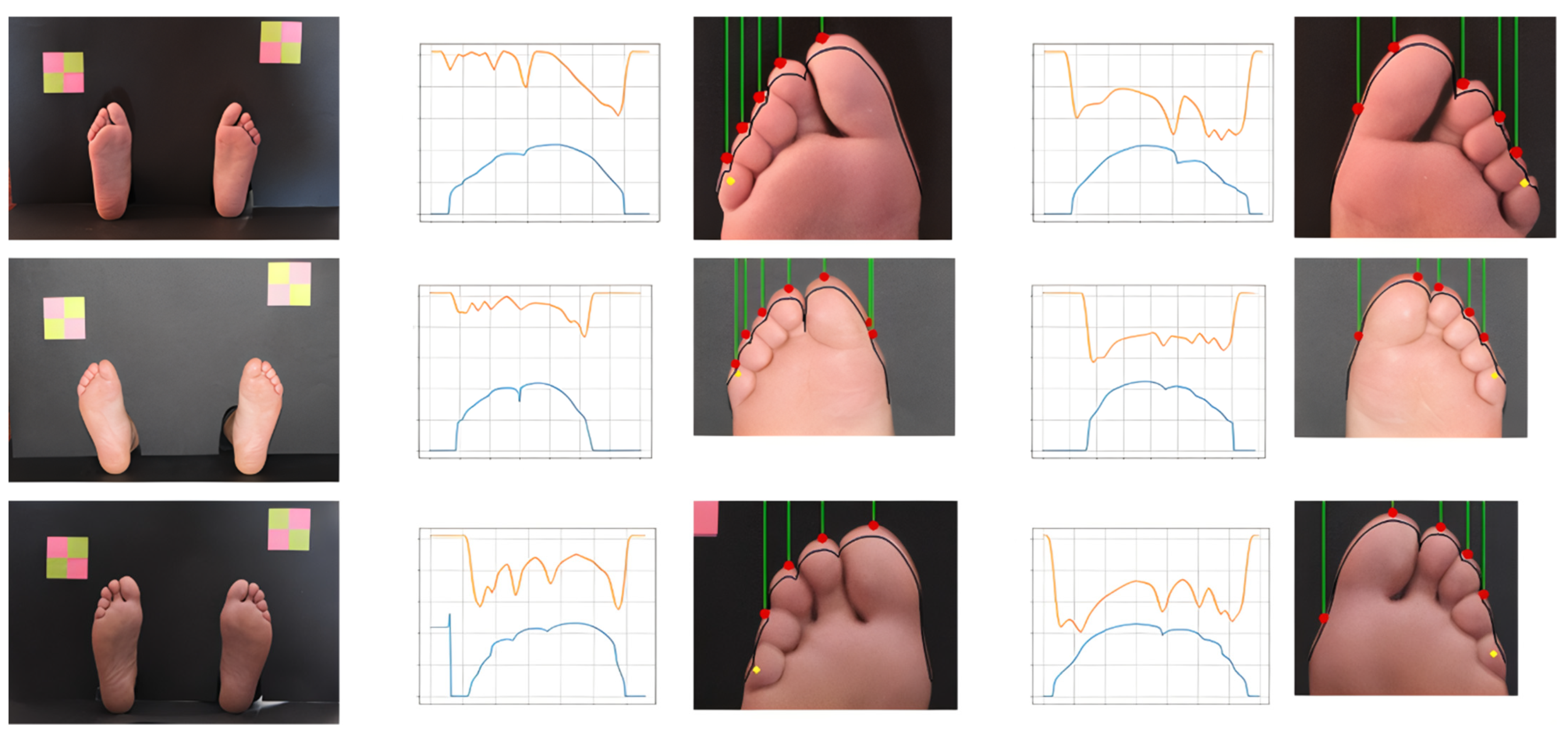 Bioengineering 09 00086 g006