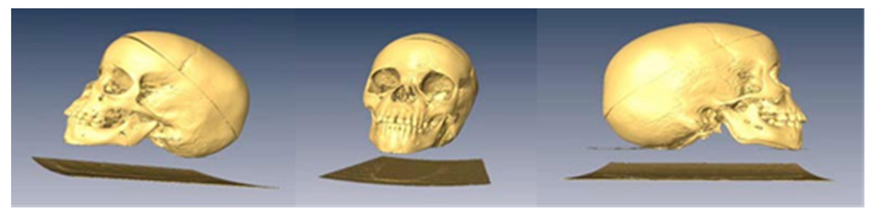 Bioengineering 09 00143 g004