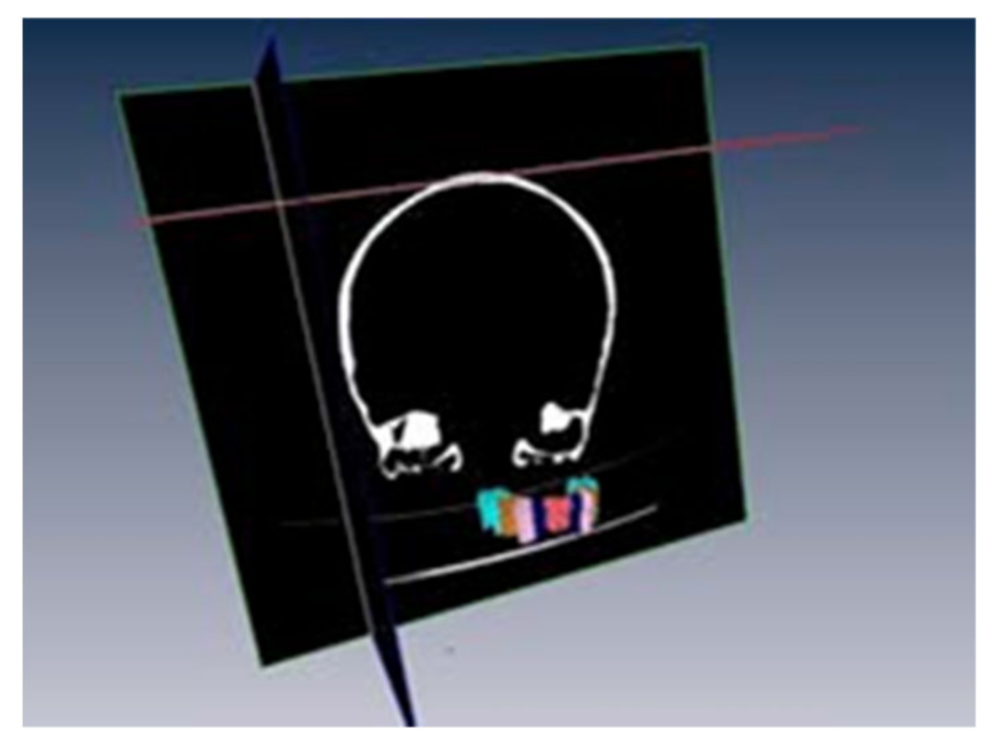 Bioengineering 09 00143 g005