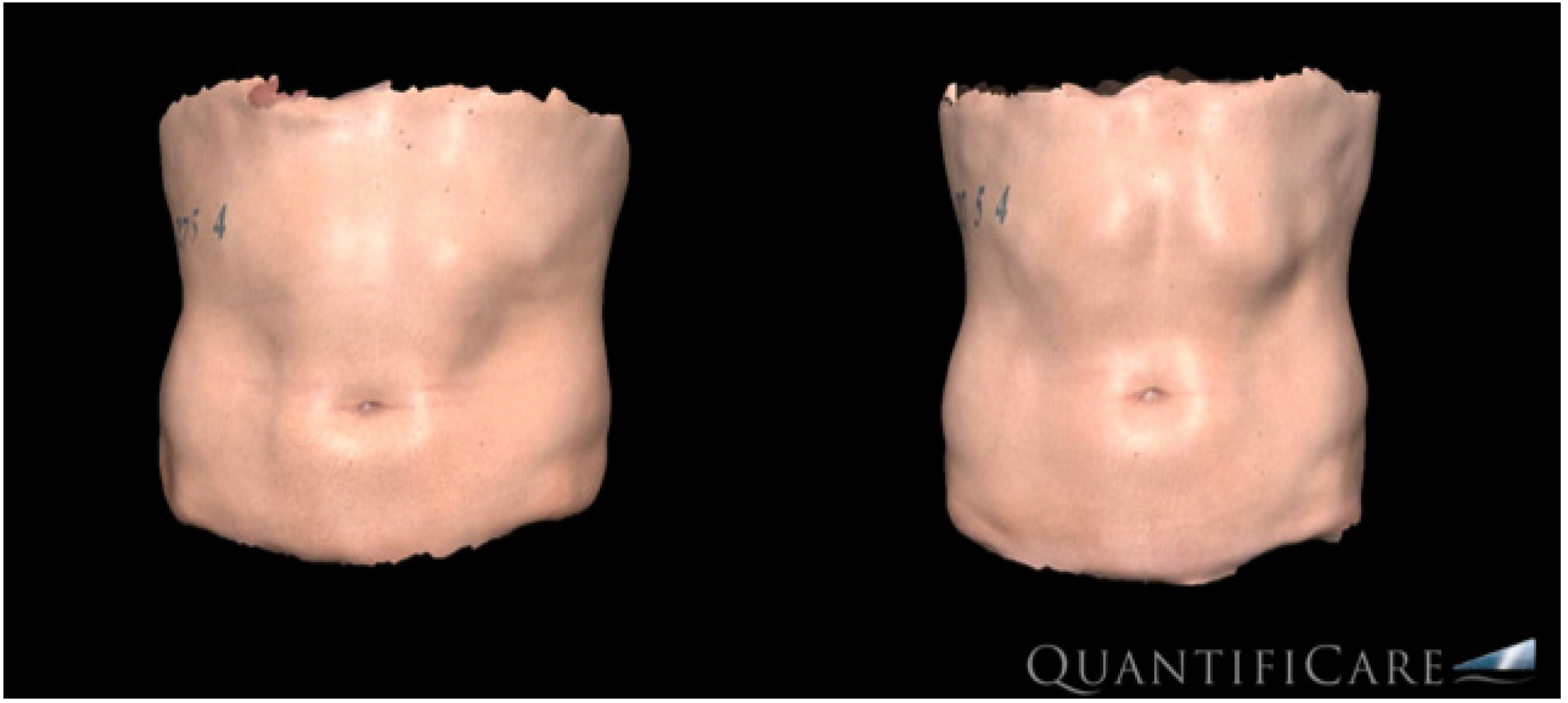 Bioengineering 09 00182 g001