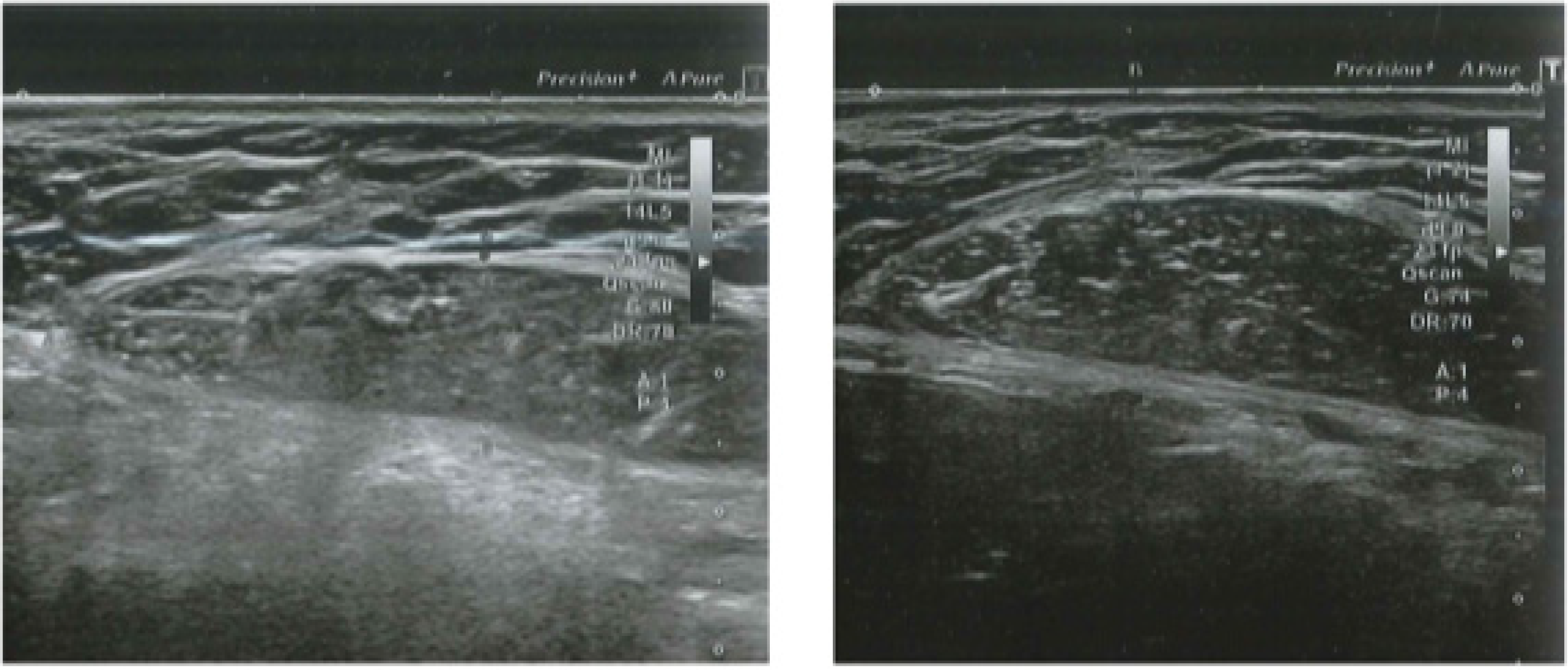 Bioengineering 09 00182 g002