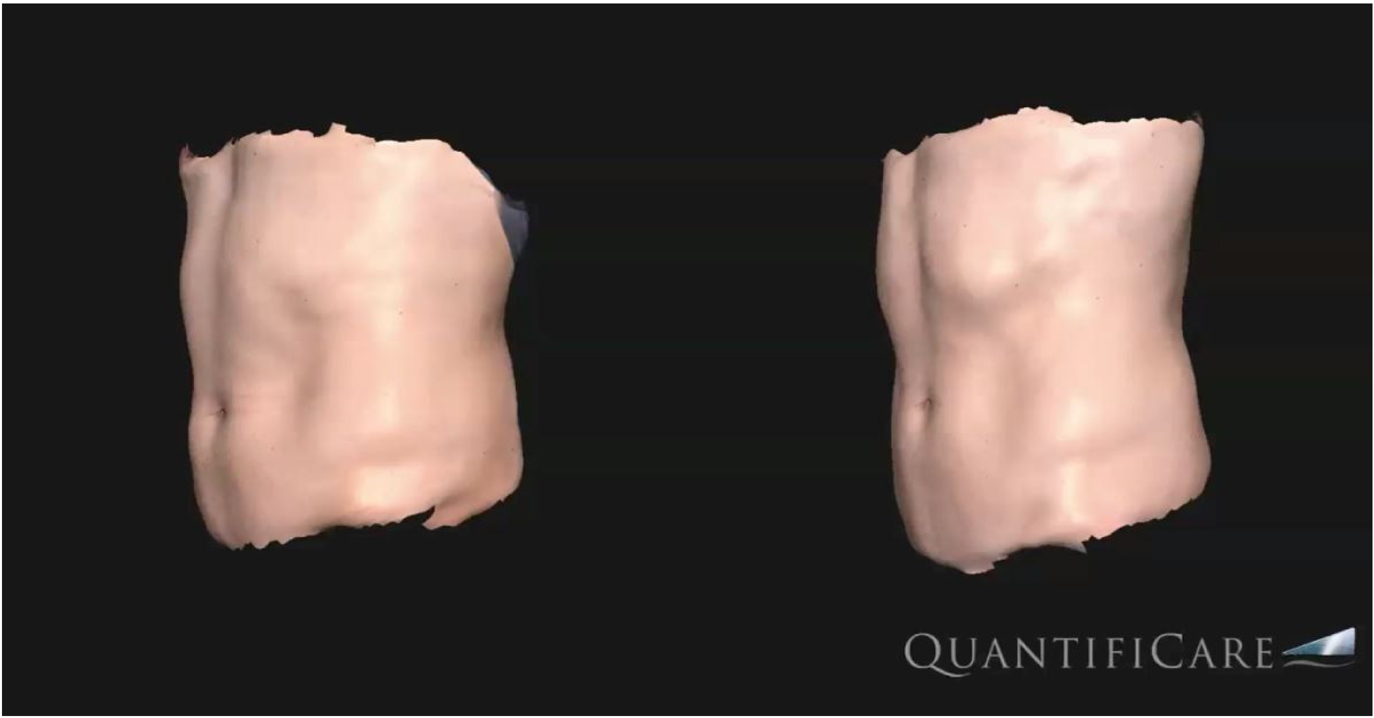 Bioengineering 09 00182 g003