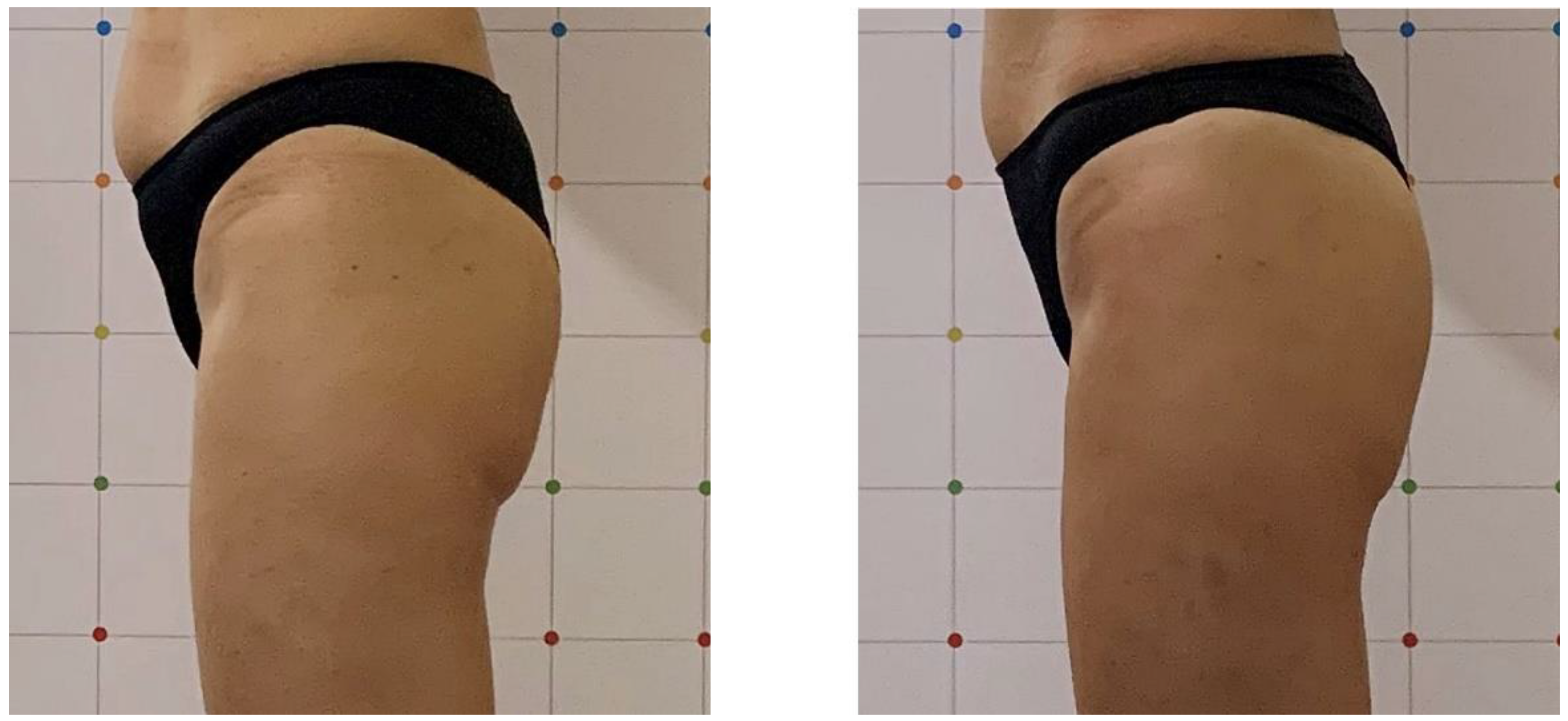 Bioengineering 09 00284 g001