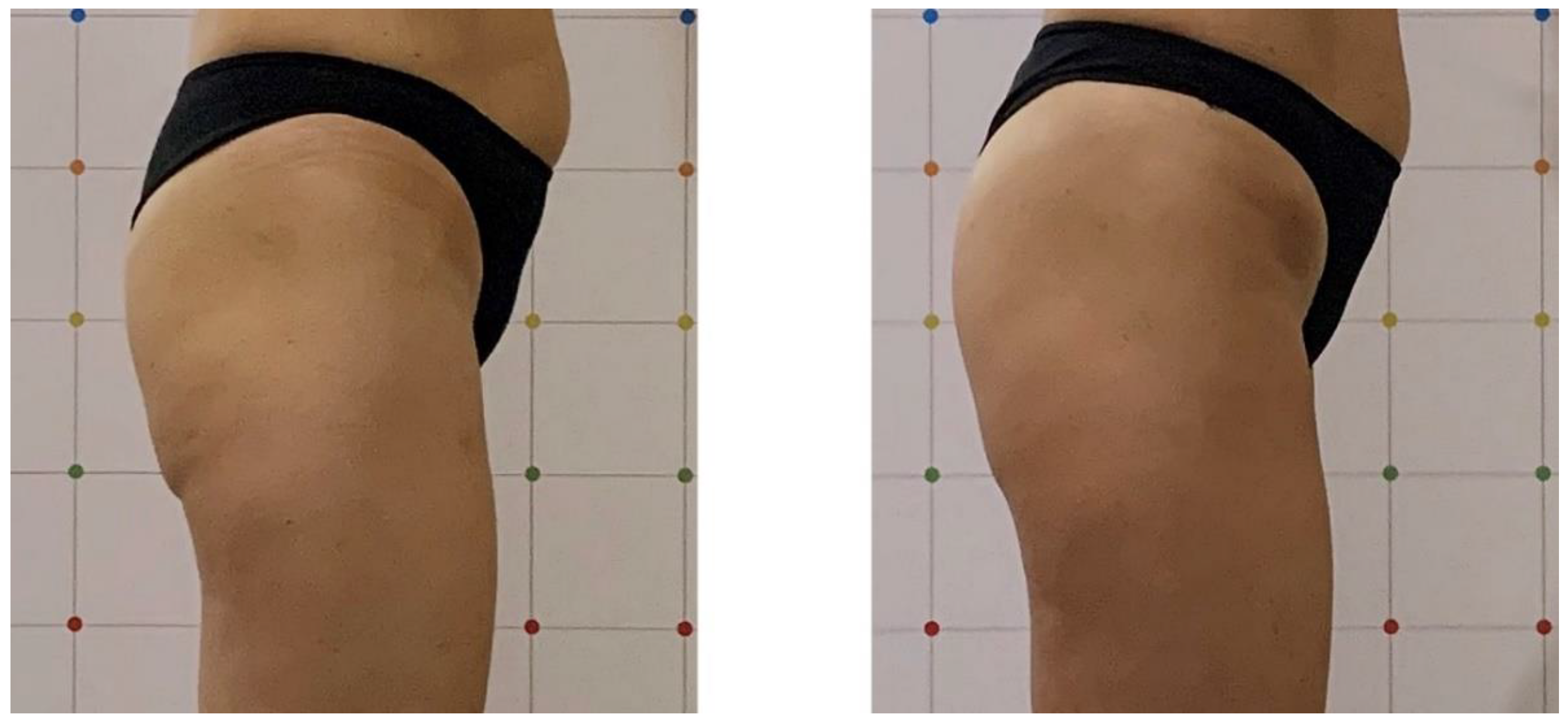 Bioengineering 09 00284 g002