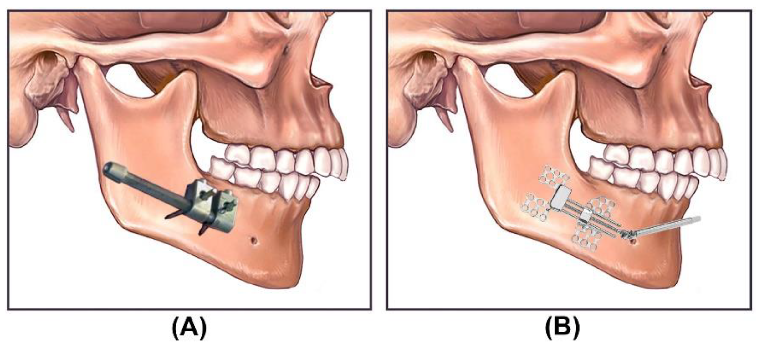Bioengineering 09 00371 g002