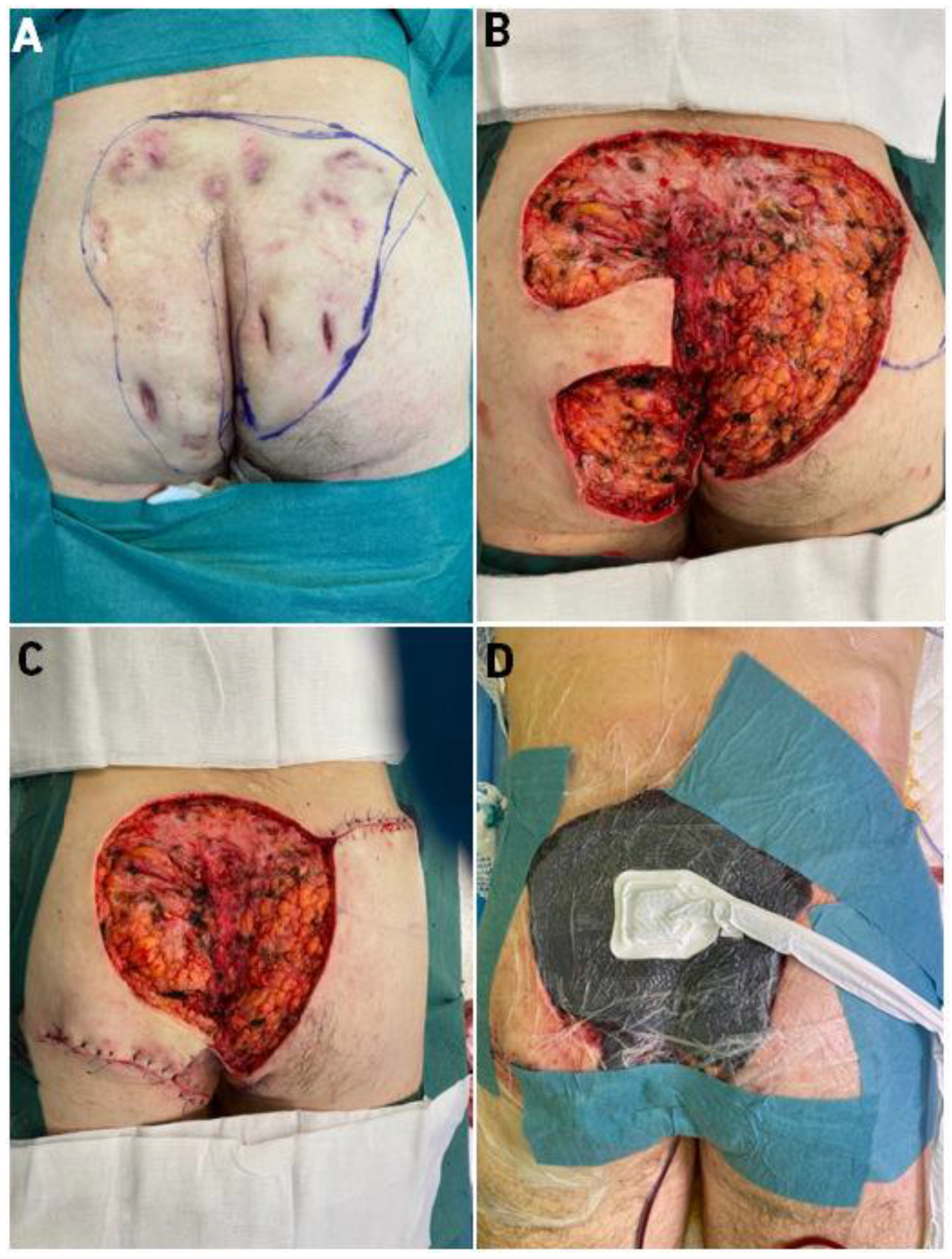 Bioengineering 09 00389 g001