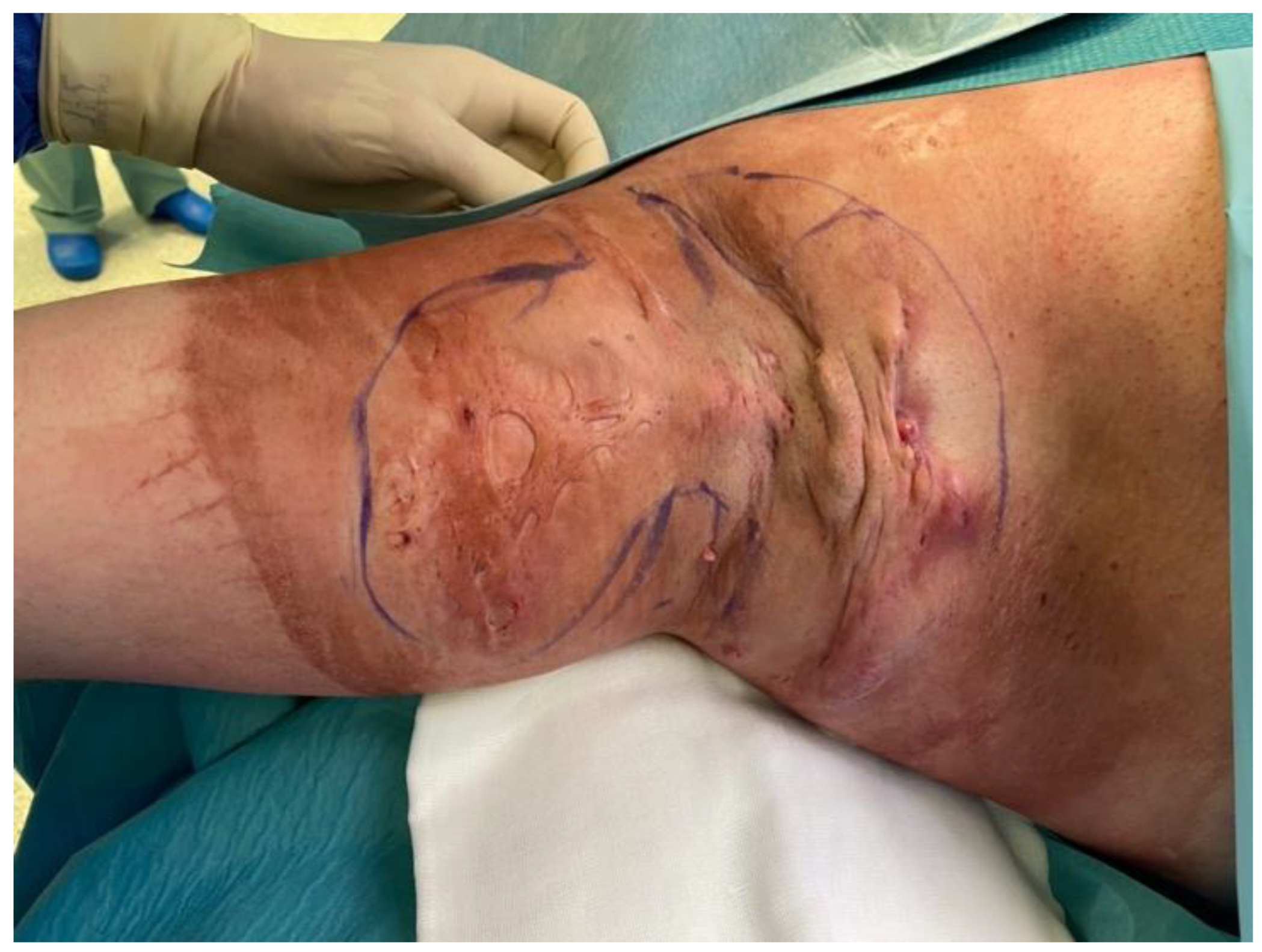 Bioengineering 09 00389 g002