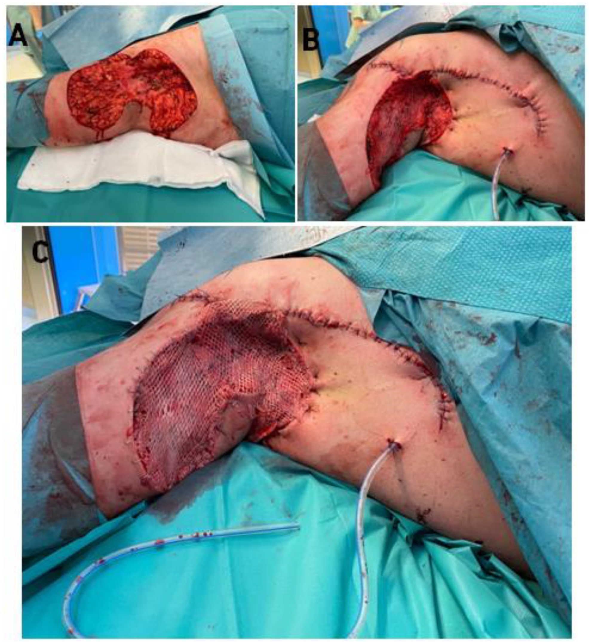 Bioengineering 09 00389 g004