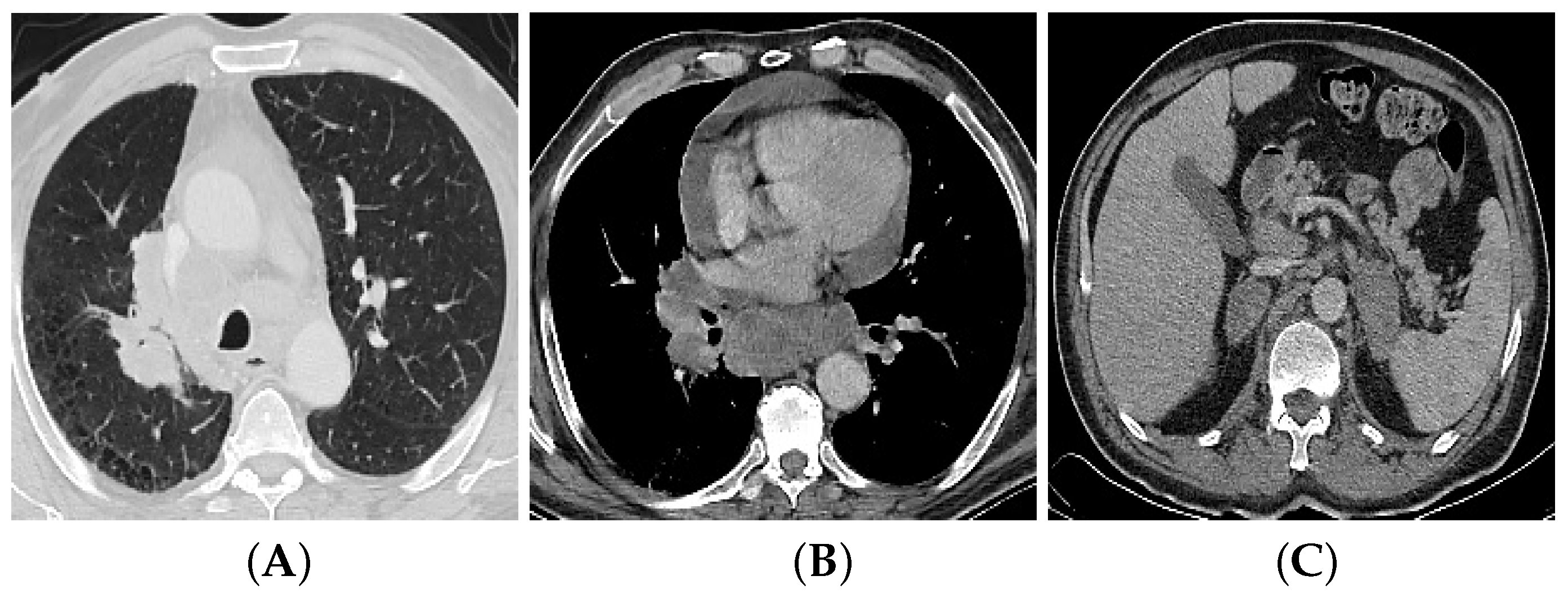 Bioengineering 09 00493 g001