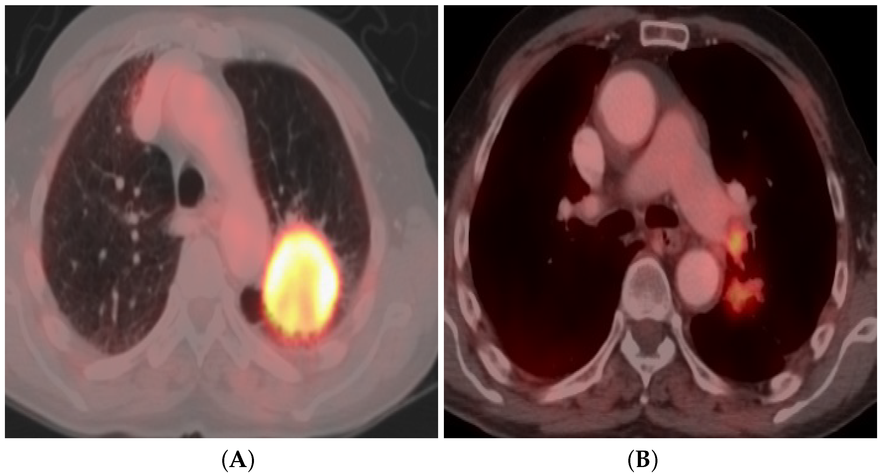 Bioengineering 09 00493 g002