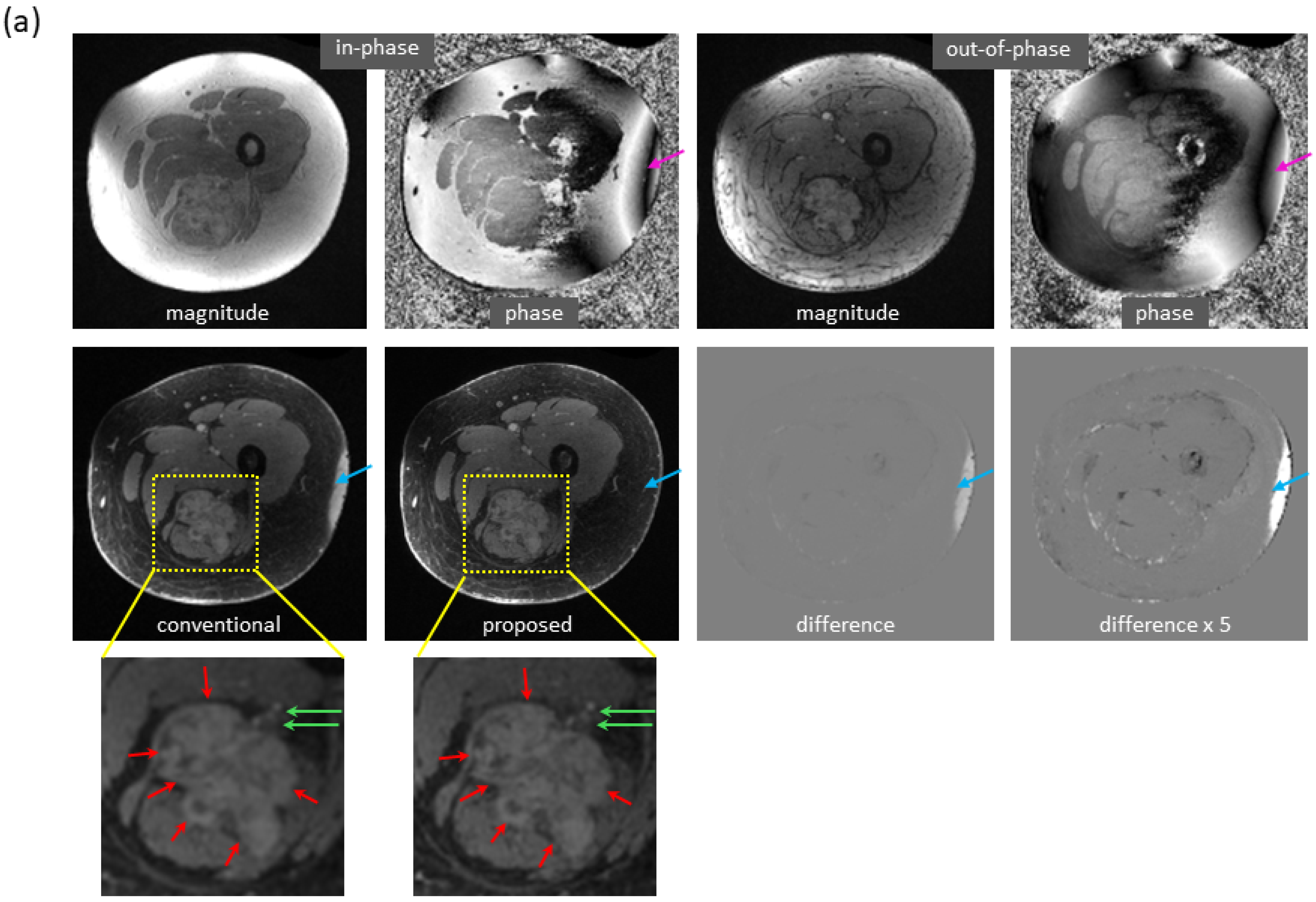 Bioengineering 09 00579 g004a Bioengineering 09 00579 g004a