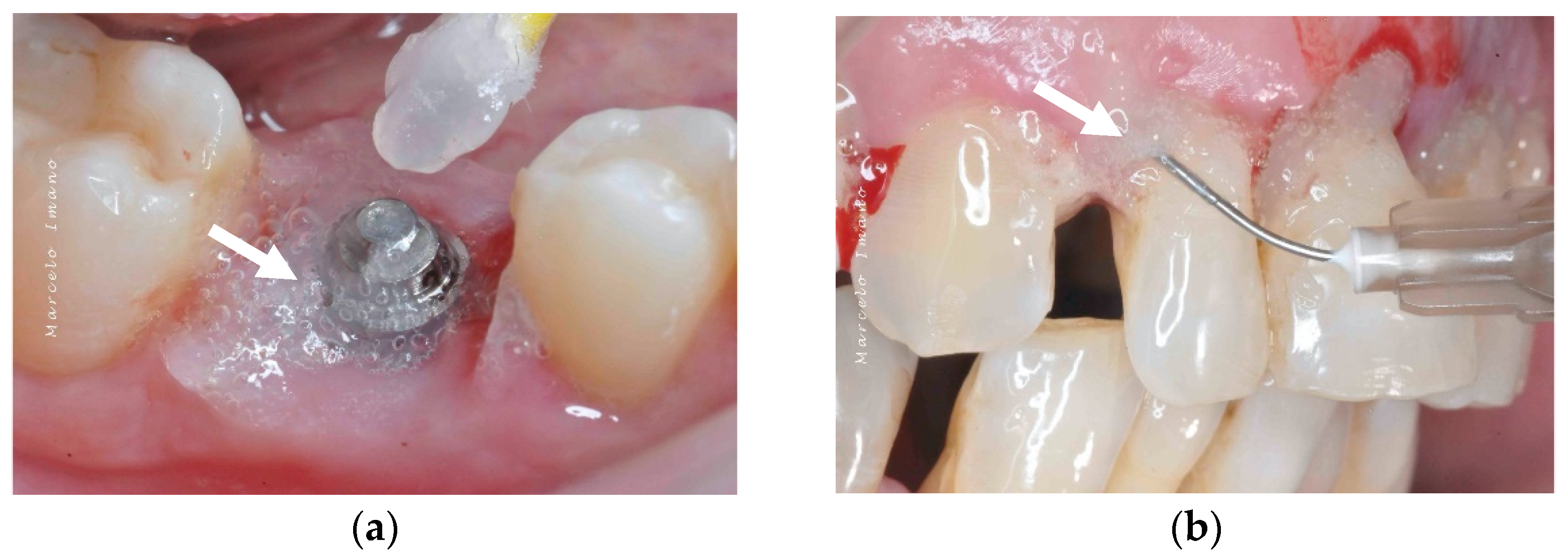Bioengineering 09 00636 g005