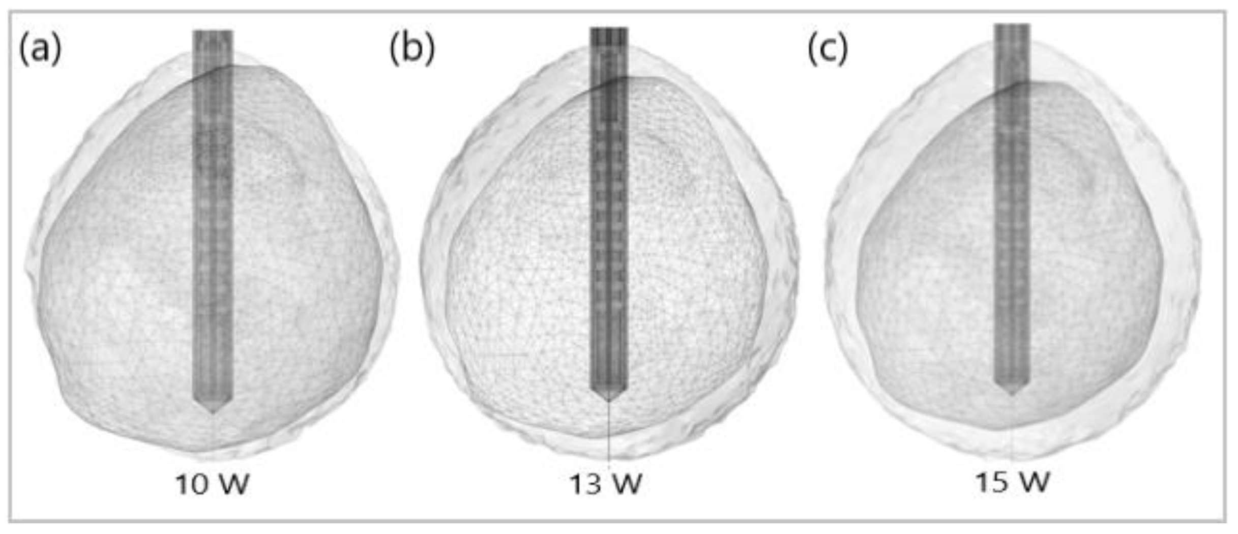 Bioengineering 09 00656 g013