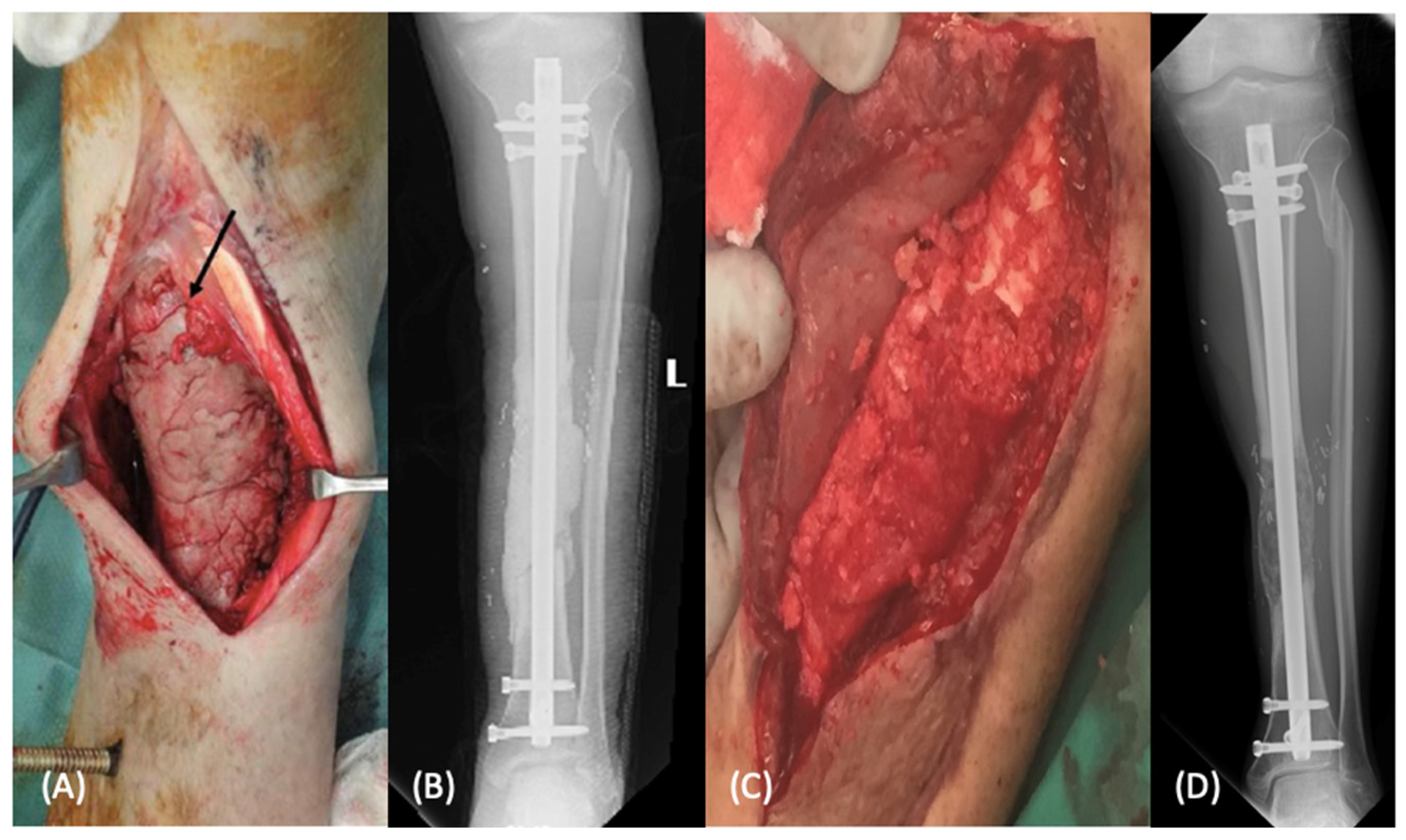 Bioengineering 09 00680 g001 Bioengineering 09 00680 g001