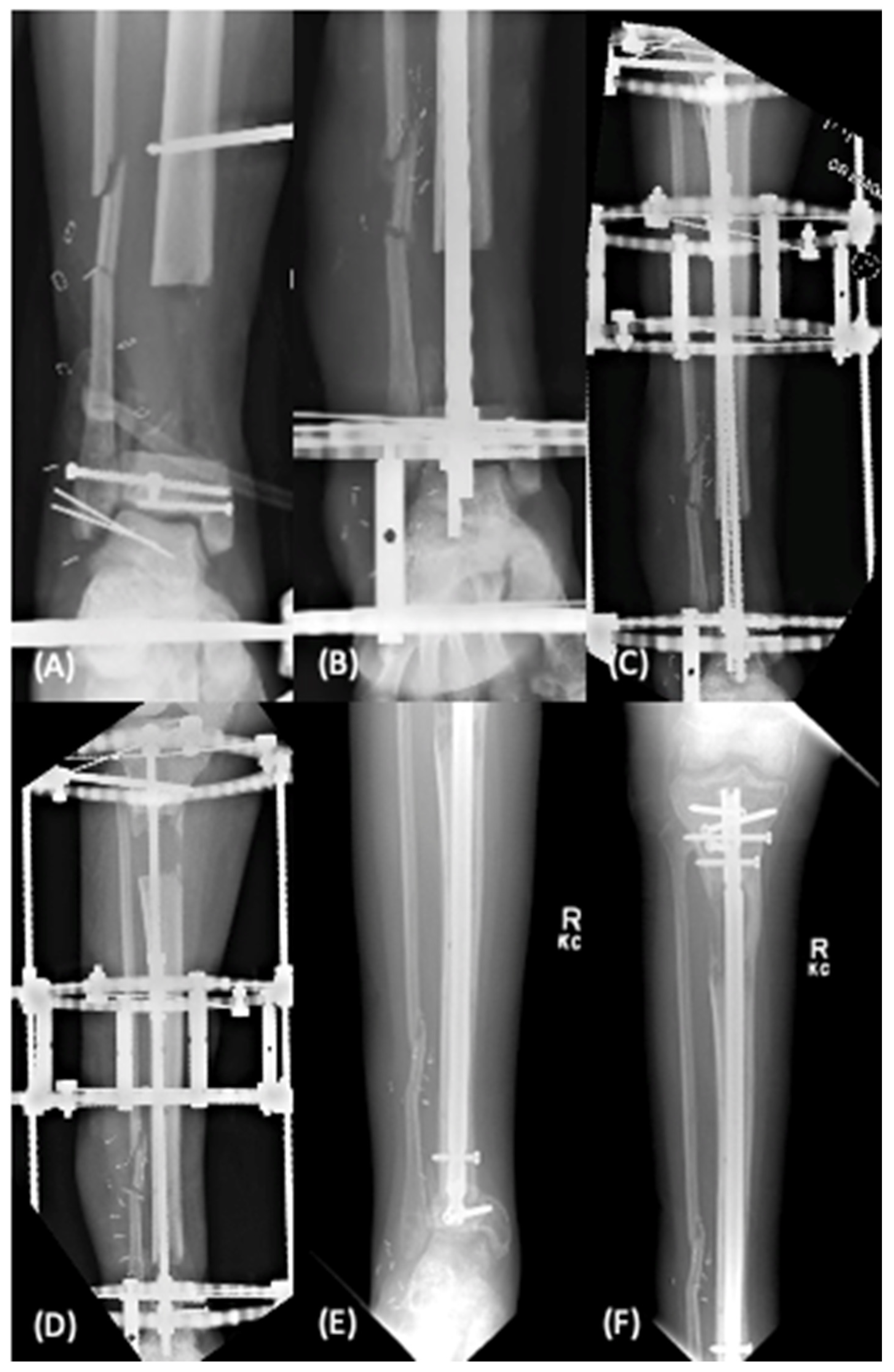 Bioengineering 09 00680 g002 Bioengineering 09 00680 g002