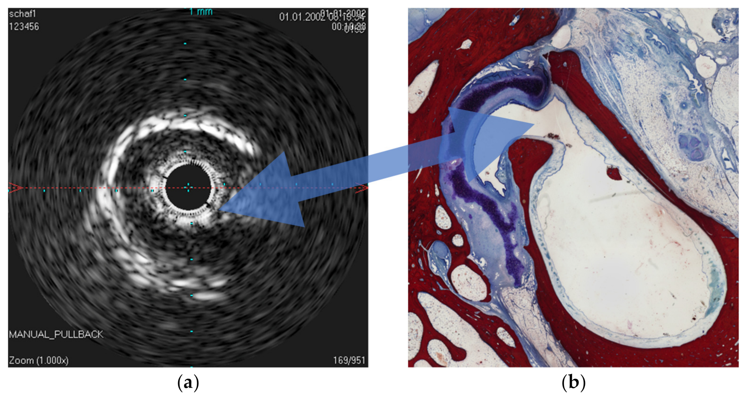 Bioengineering 09 00733 g002