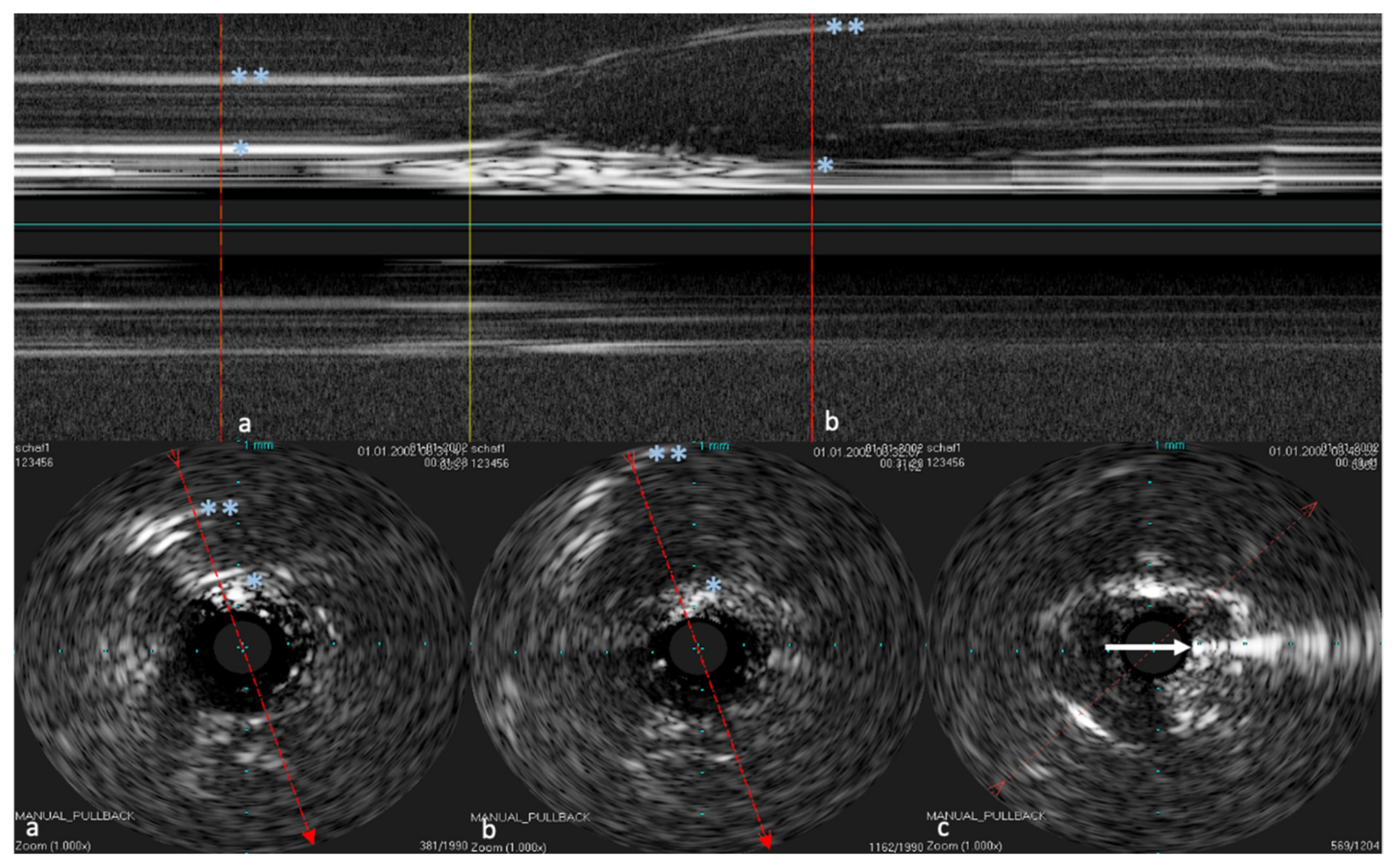 Bioengineering 09 00733 g006