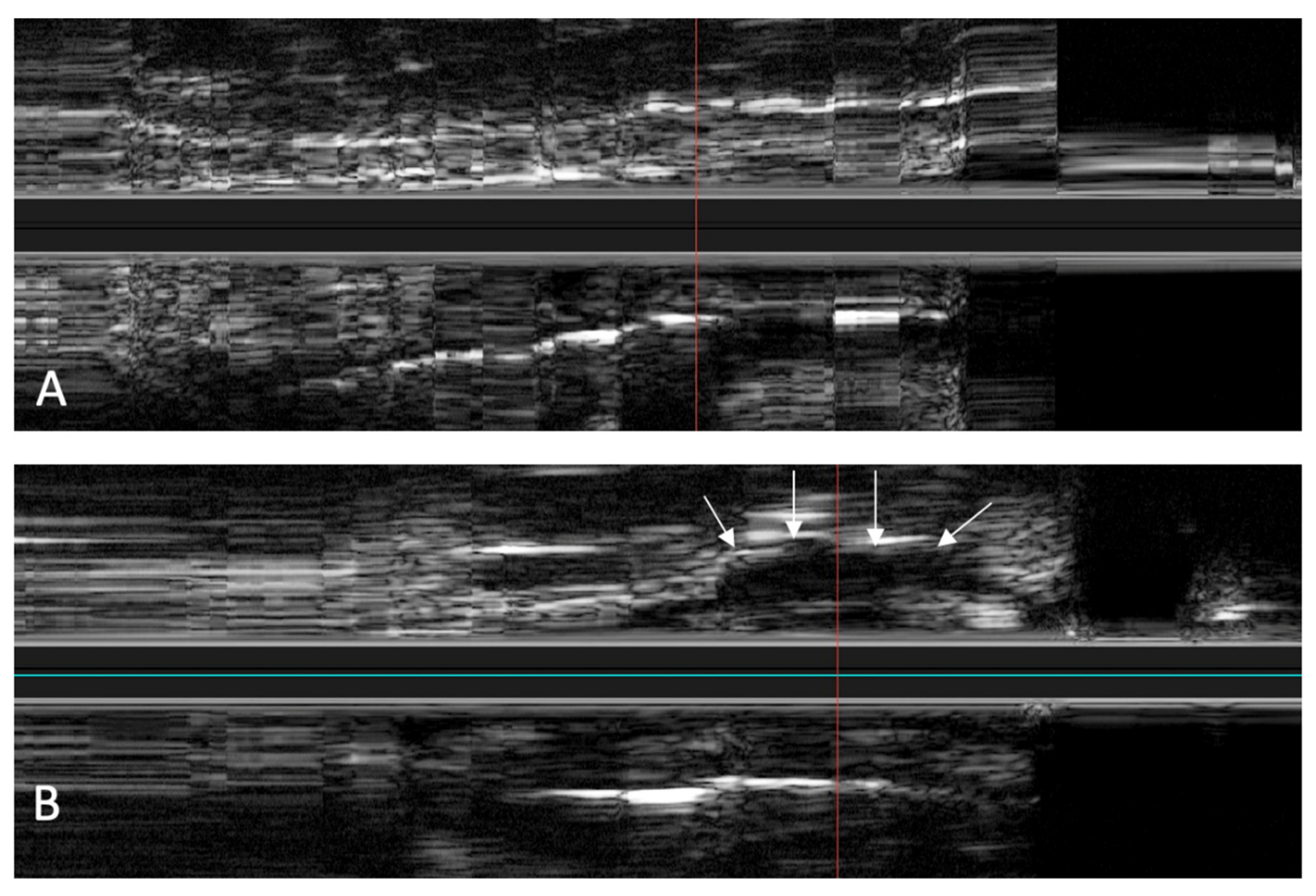 Bioengineering 09 00733 g010