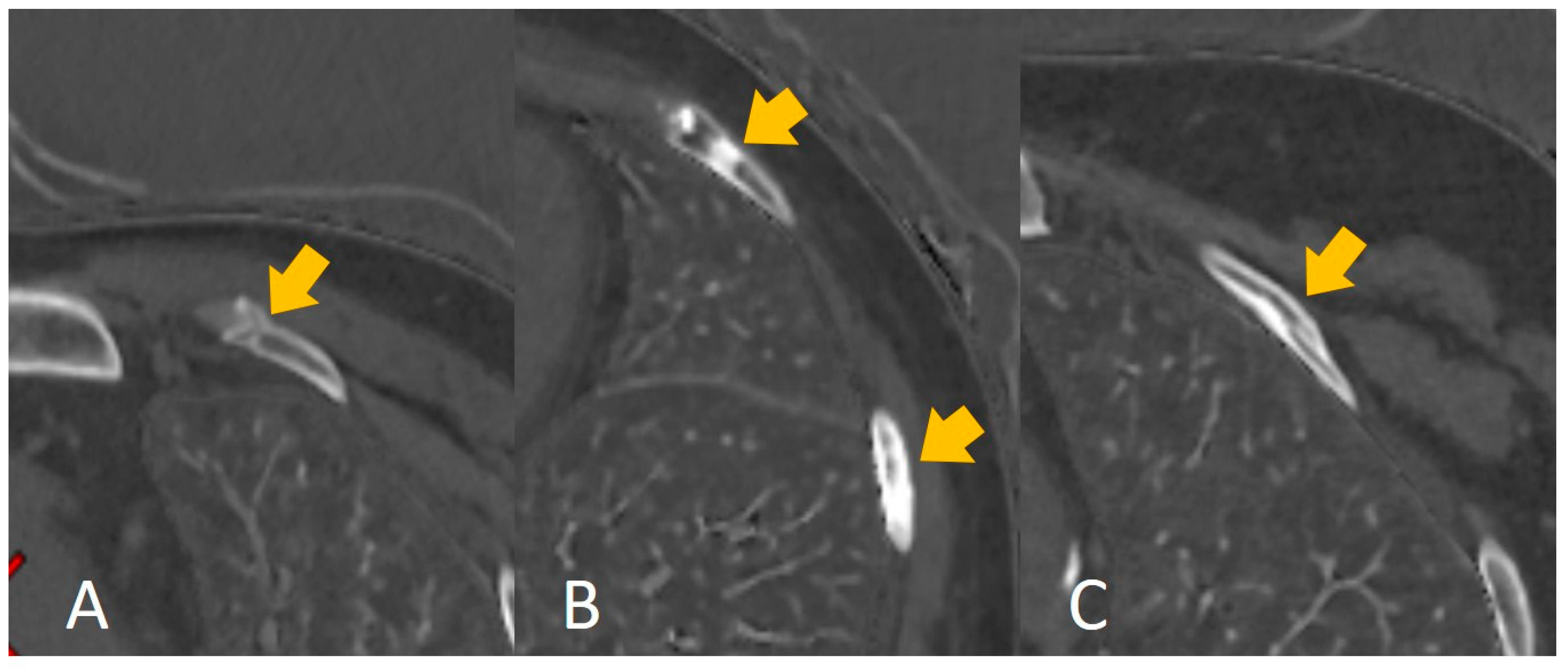 Bioengineering 10 00008 g006 Bioengineering 10 00008 g006