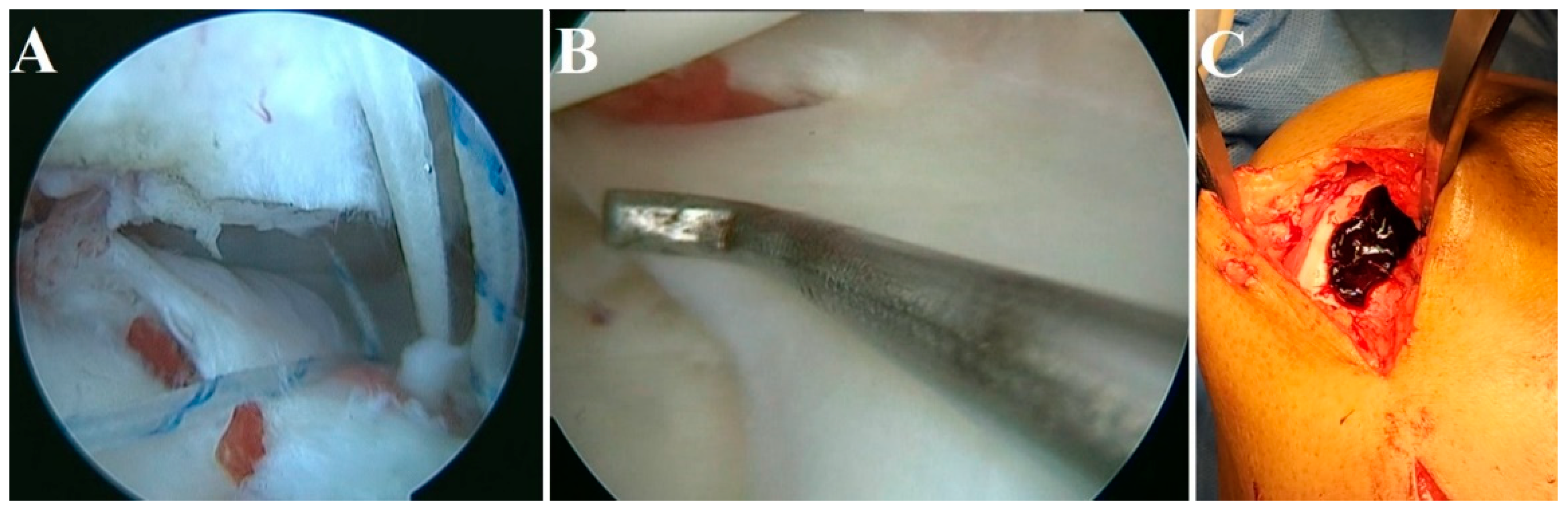 Bioengineering 10 00058 g005