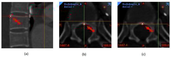 Bioengineering 10 00139 g0a3