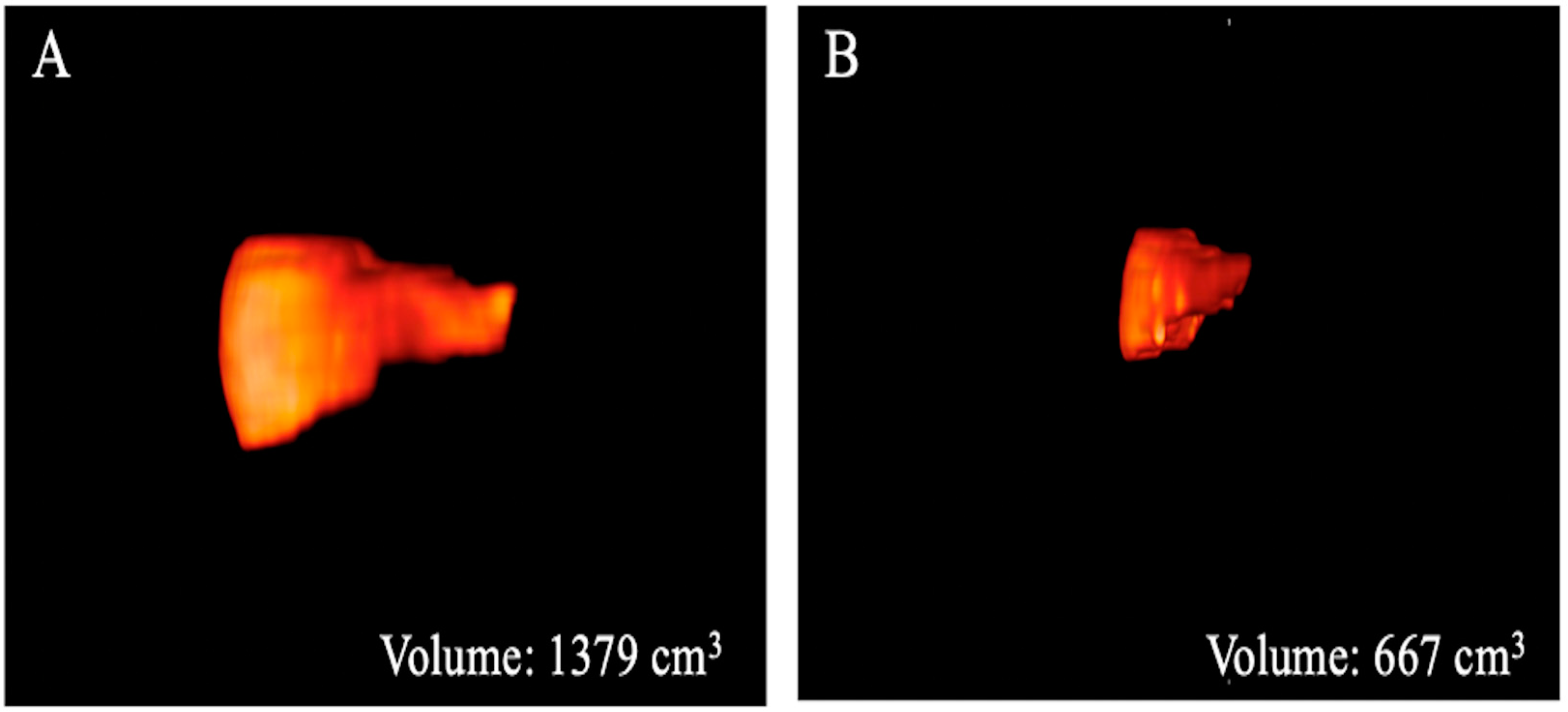 Bioengineering 10 00306 g003
