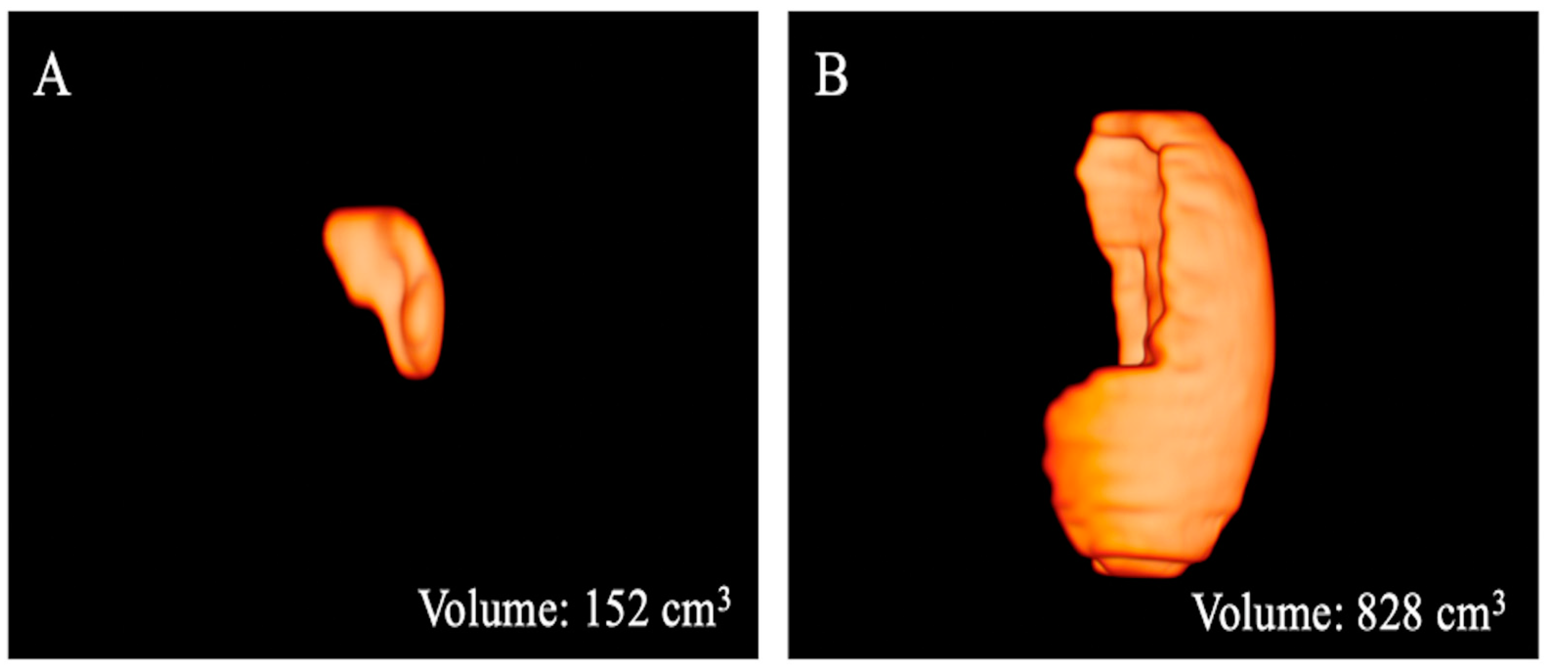 Bioengineering 10 00306 g004