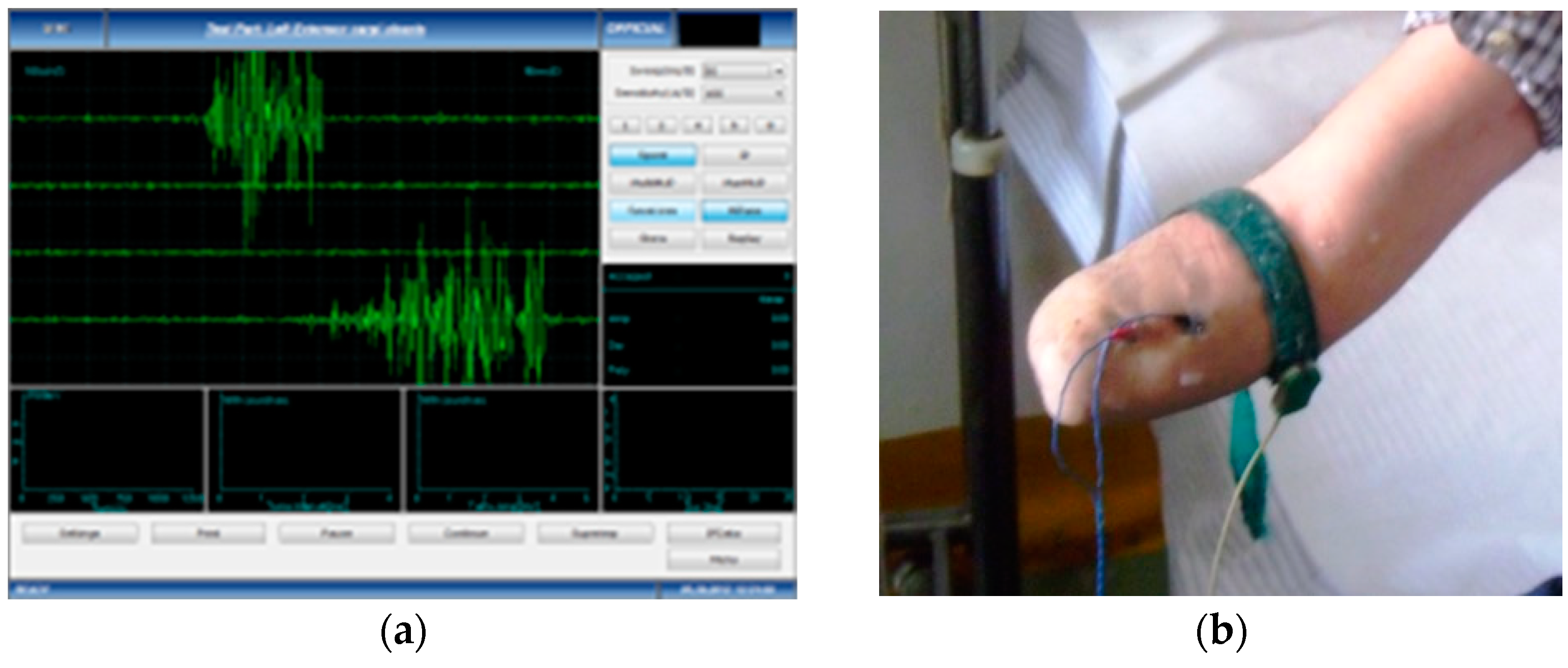 Bioengineering 10 00319 g001