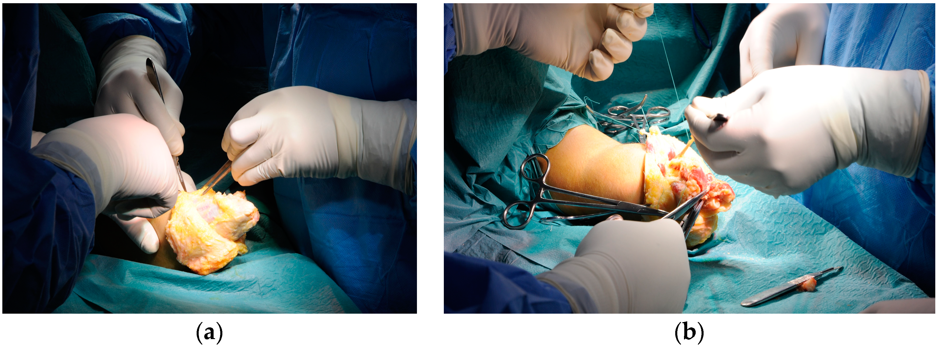 Bioengineering 10 00319 g006