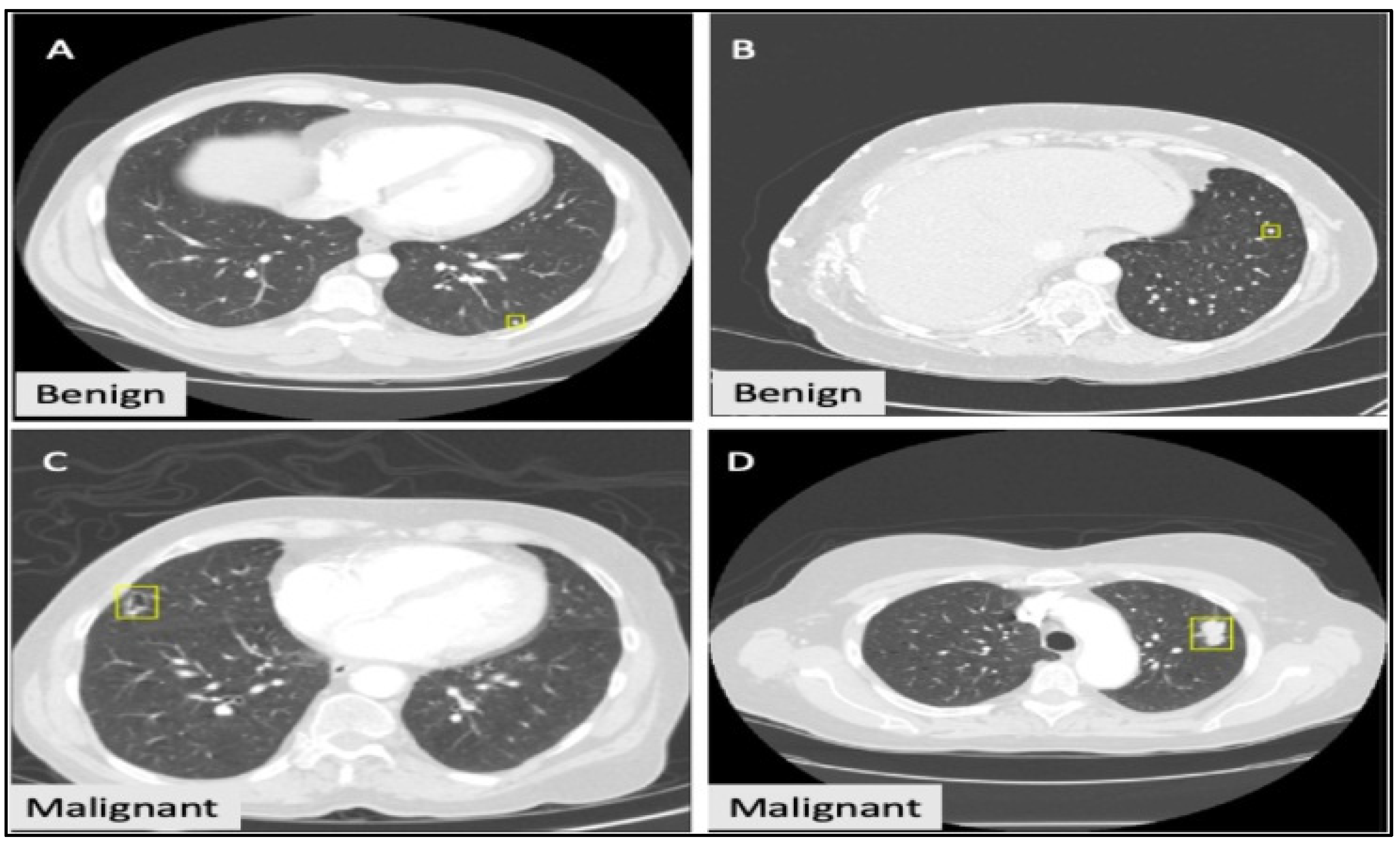 Bioengineering 10 00320 g006 Bioengineering 10 00320 g006