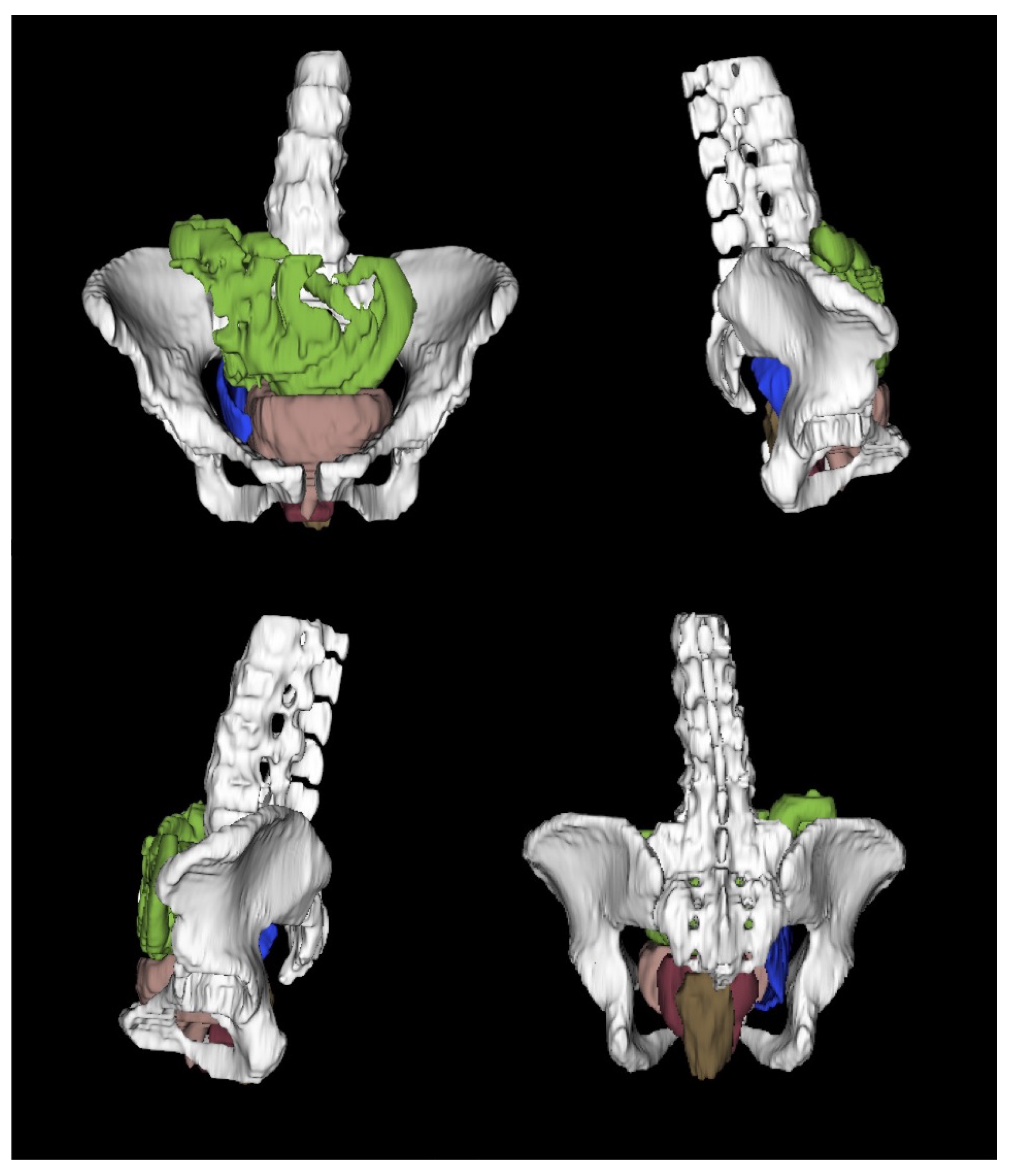 Bioengineering 10 00329 g002 Bioengineering 10 00329 g002