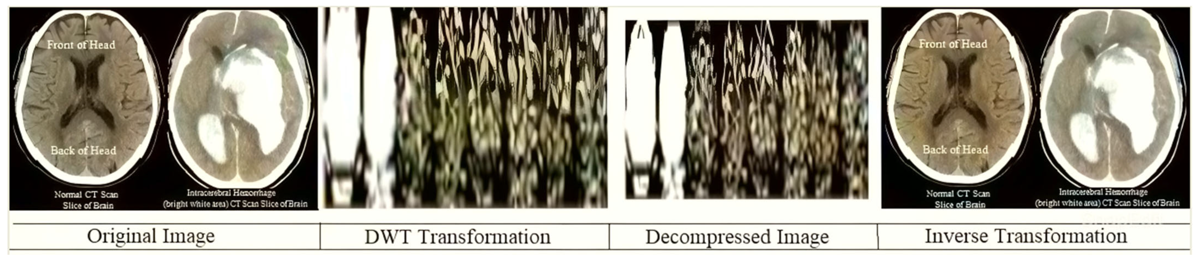 Bioengineering 10 00333 g003