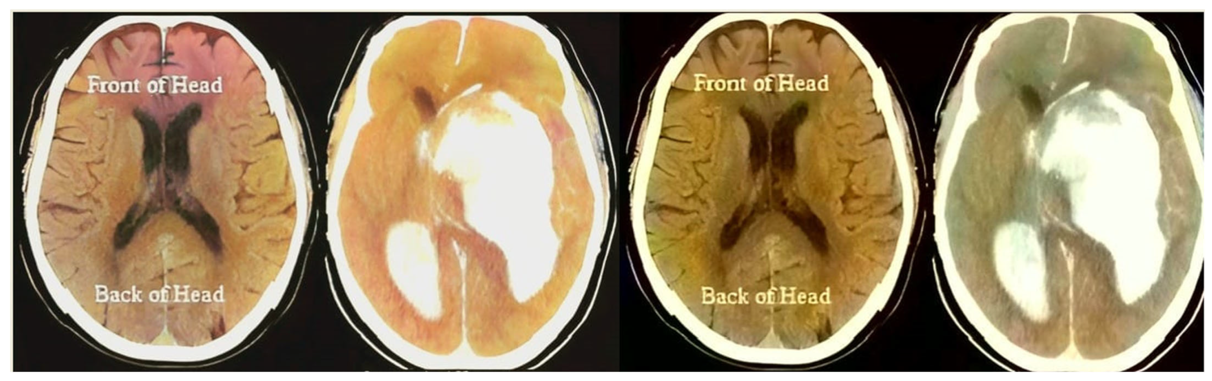 Bioengineering 10 00333 g004