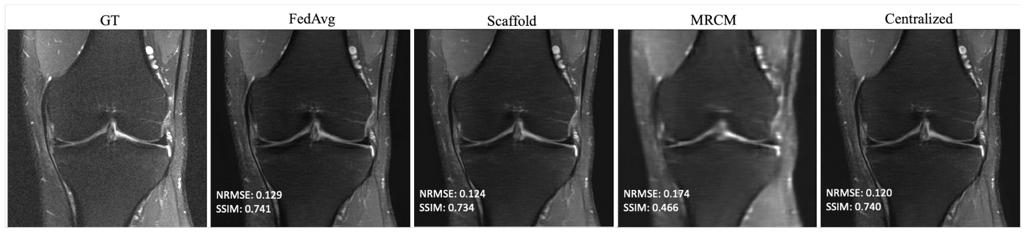 Bioengineering 10 00364 g003