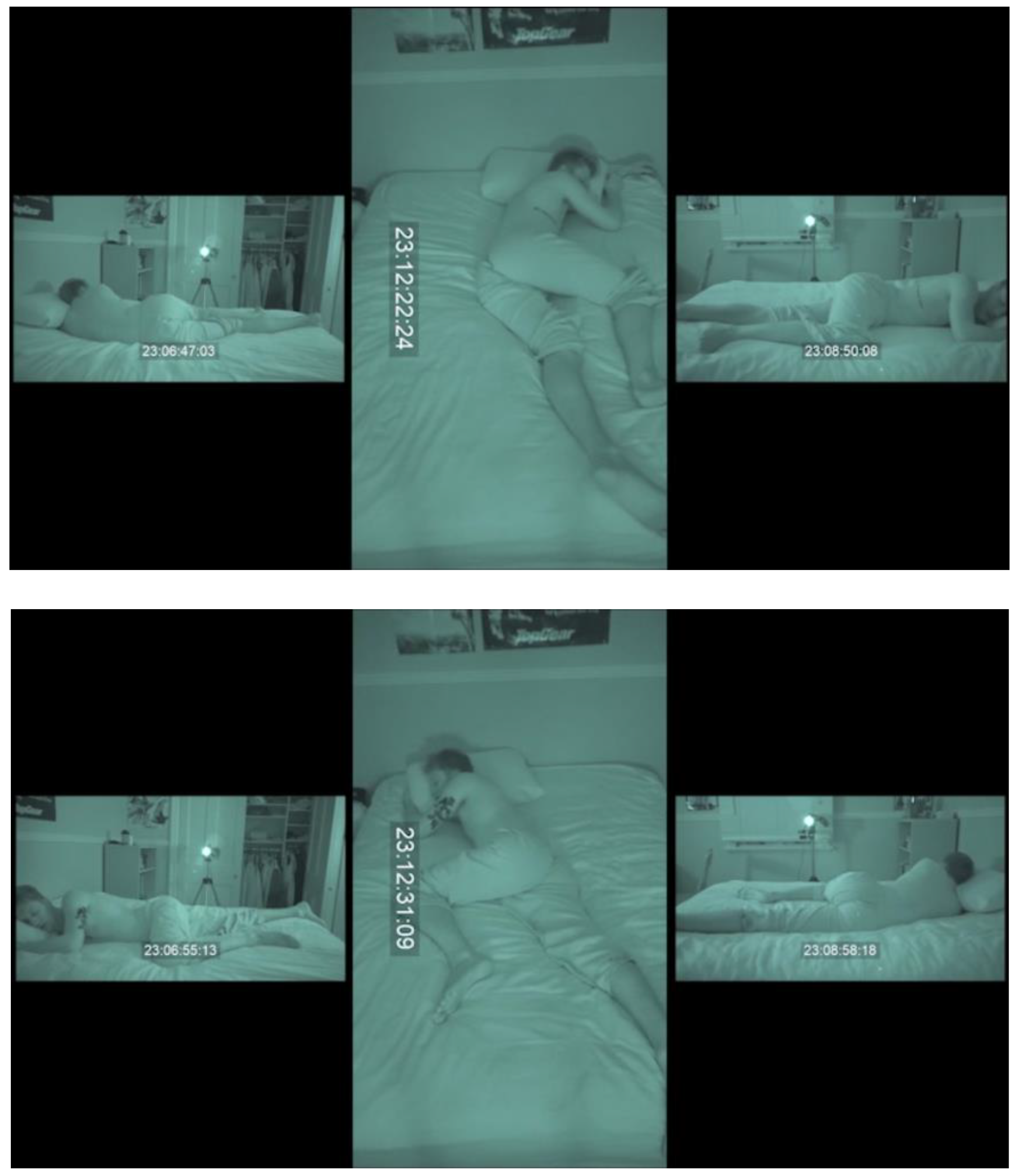 Bioengineering 10 00408 g004